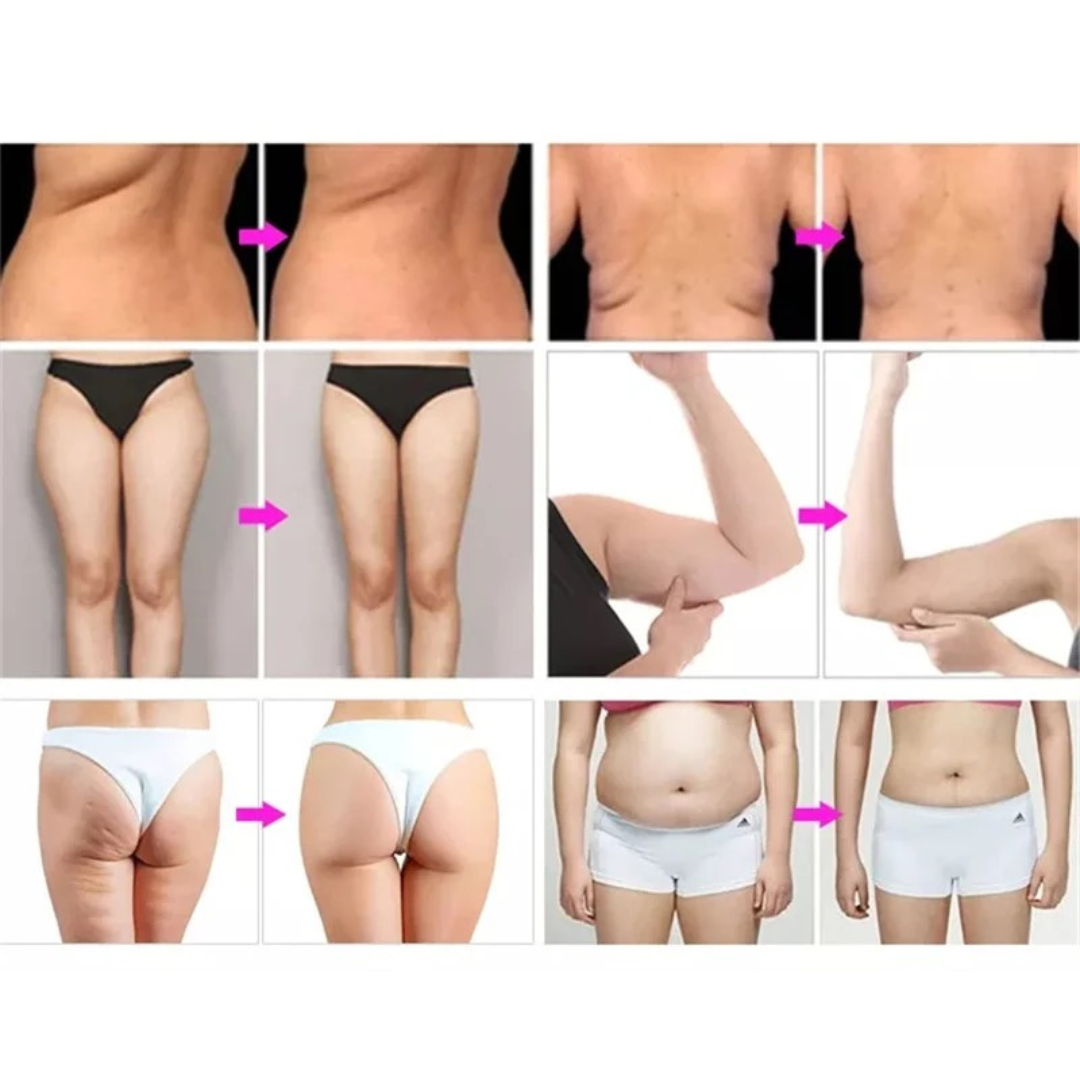 5D Vacuum RF 80K Cavitation Machine for Body Slimming & Cellulite Removal - Professional Non-Invasive Fat Reduction & Skin Tightening Device for Home Spa & Beauty Salon Use