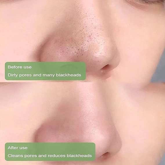 Infi Style Tea Tree Cleansing Mask Stick for Face - Blackhead Removal, Oil Control & Anti-Acne Treatment | Purifying Clay Detox Mud Mask with Hyaluronic Acid | Pack of 2 | Made in India | Perfect for Deep Cleansing & Pore Minimizing in Daily Skincare Routine