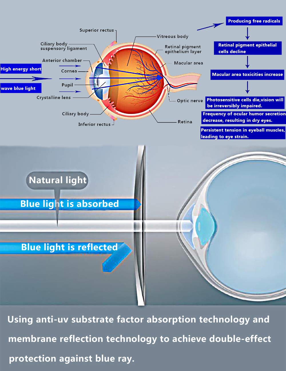 Blue Light Blocking Glasses for Computer & Gaming - Sirain Anti Blue Ray Round Frame Eyewear for Eye Strain Relief & Digital Screen Protection