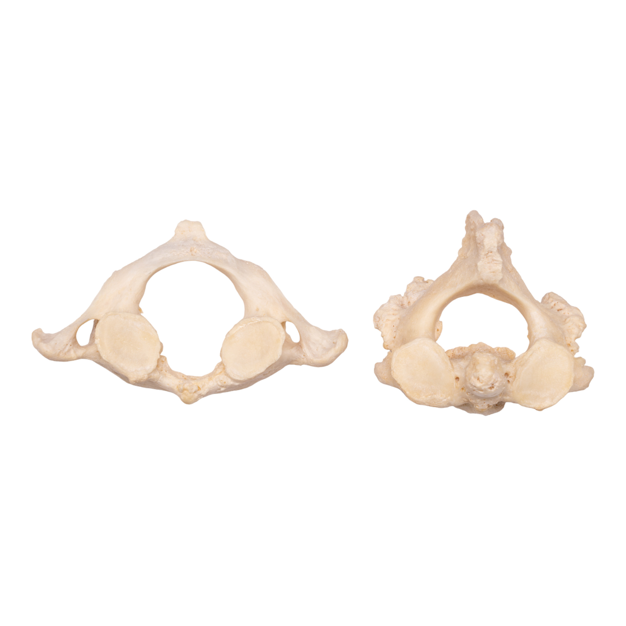Premium Human Vertebrae Specimen for Medical Research & Education - Ideal for Anatomy Study, Medical Training, and Forensic Science Applications