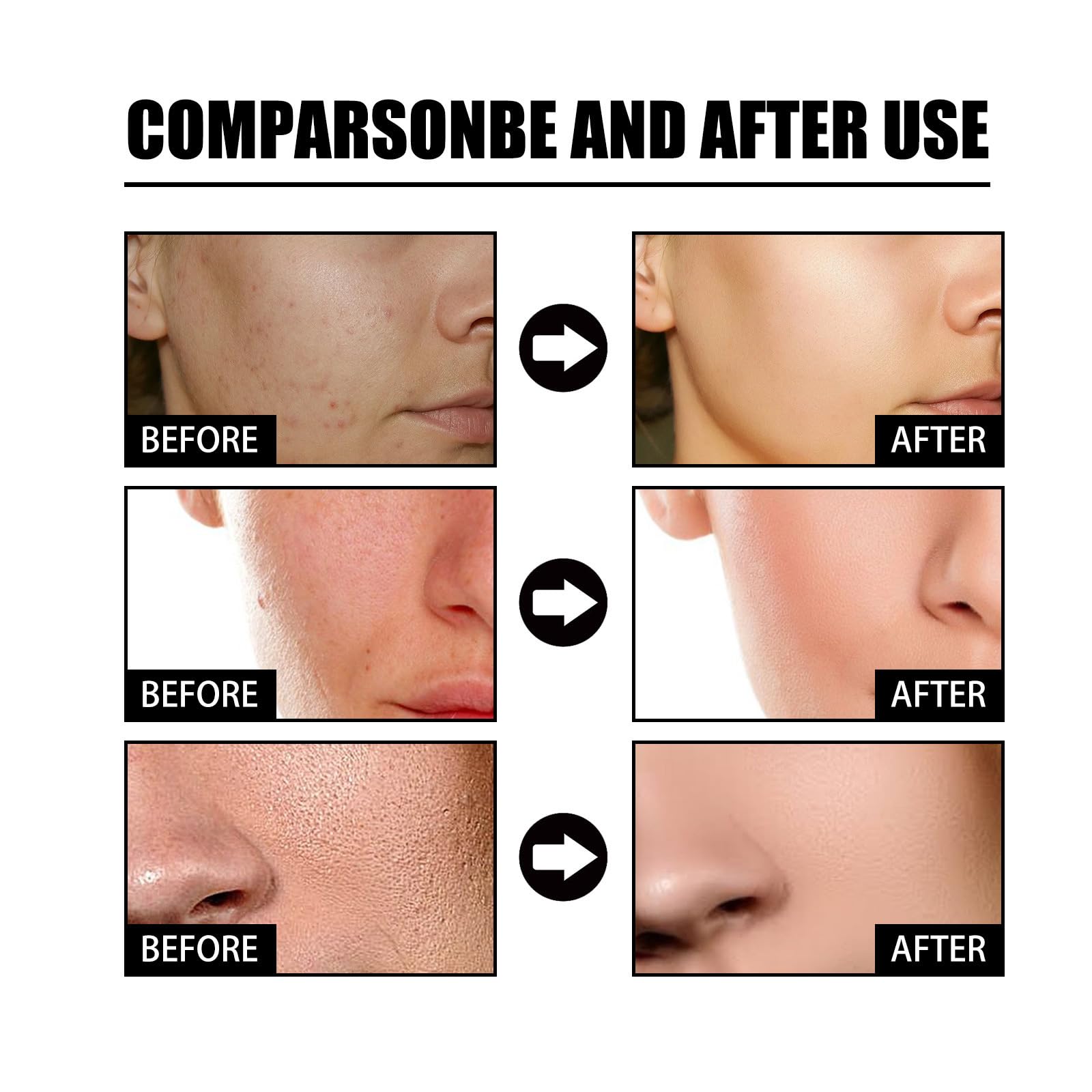 Niacinamide Serum for Freckles & Blemish Removal - Brightening Facial Treatment for Dark Spots & Hyperpigmentation | Perfect for Daily Skincare Routine & Nighttime Use