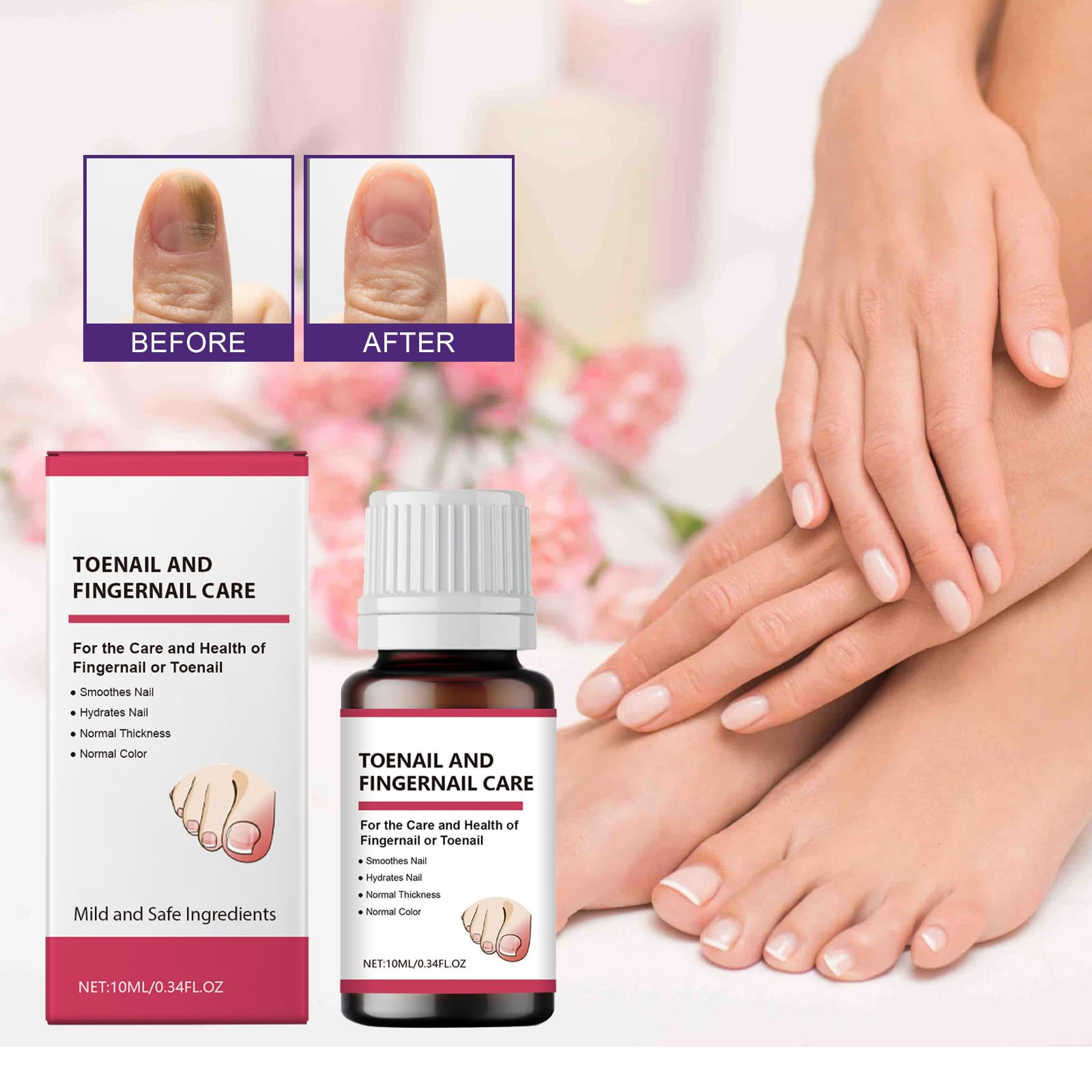 Extra Strength Toenail Fungus Treatment - Natural Ingredients for Fast Relief (2 Bottles) - Effective Solution for Toenail Fungus & Healthy Nail Care at Home