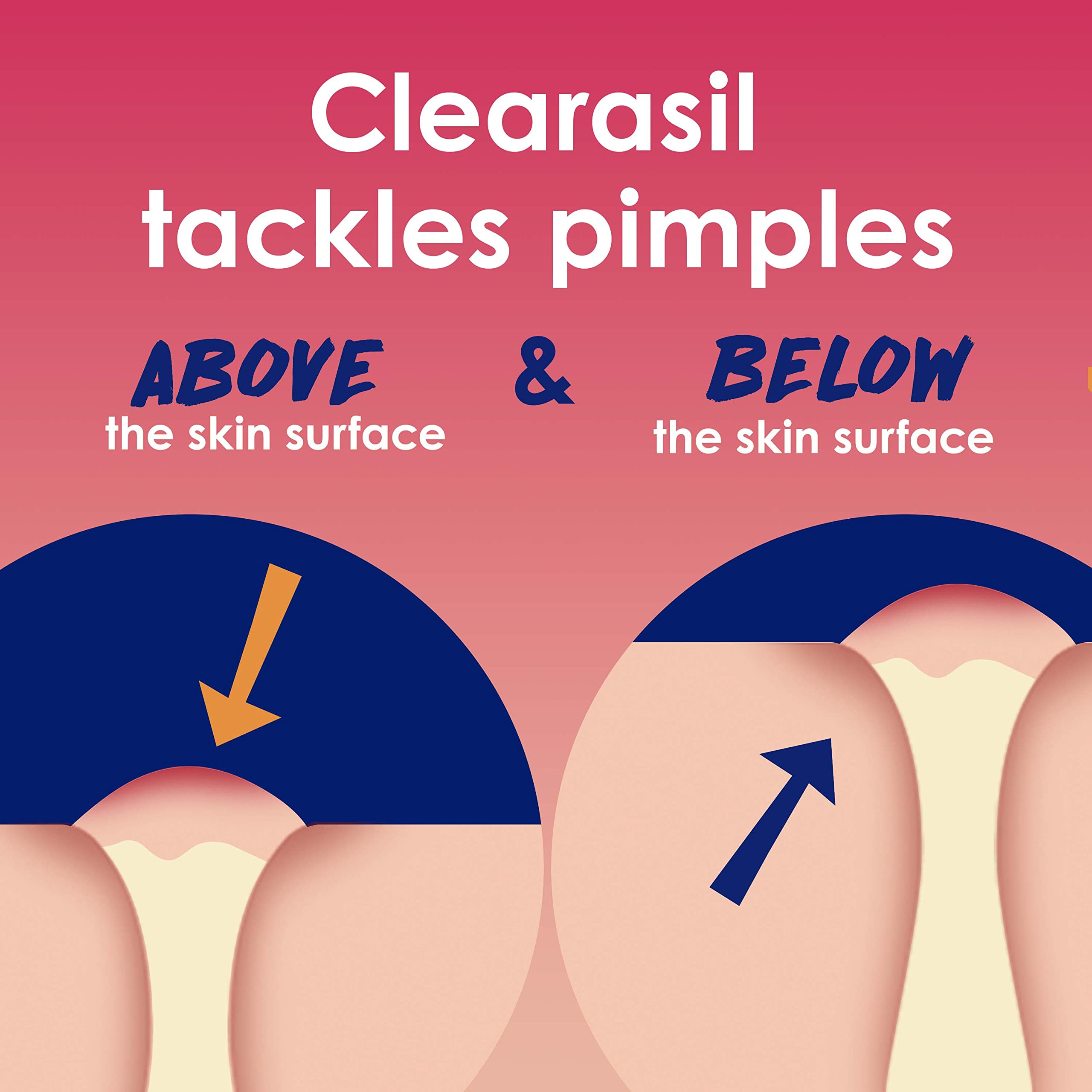 Clearasil Rapid Rescue Deep Treatment Acne Face Pads - Maximum Strength 2% Salicylic Acid Acne Medicine (90 Count) | Dermatologist-Recommended for Oily Skin & Breakout Control | Perfect for Daily Skincare Routine & Travel