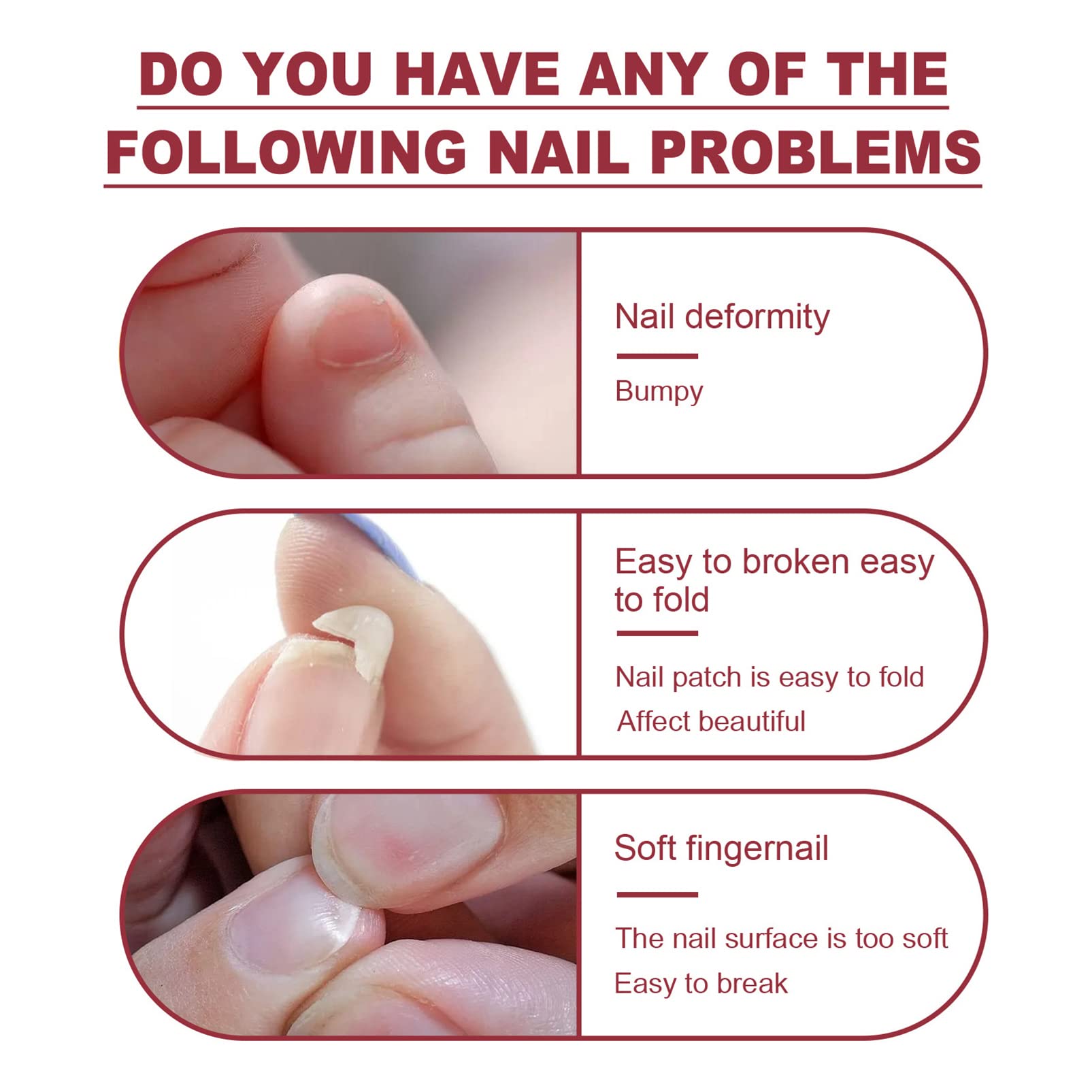 Instant Nail Glue & Cracked Nail Repair Gel - Professional Nail Treatment Strengthener, Hardener & Fixer for Broken Natural Nails - Nail Extension Sculpture Gel Kit (20ml) - Perfect for Salon, Home Manicures & DIY Nail Art