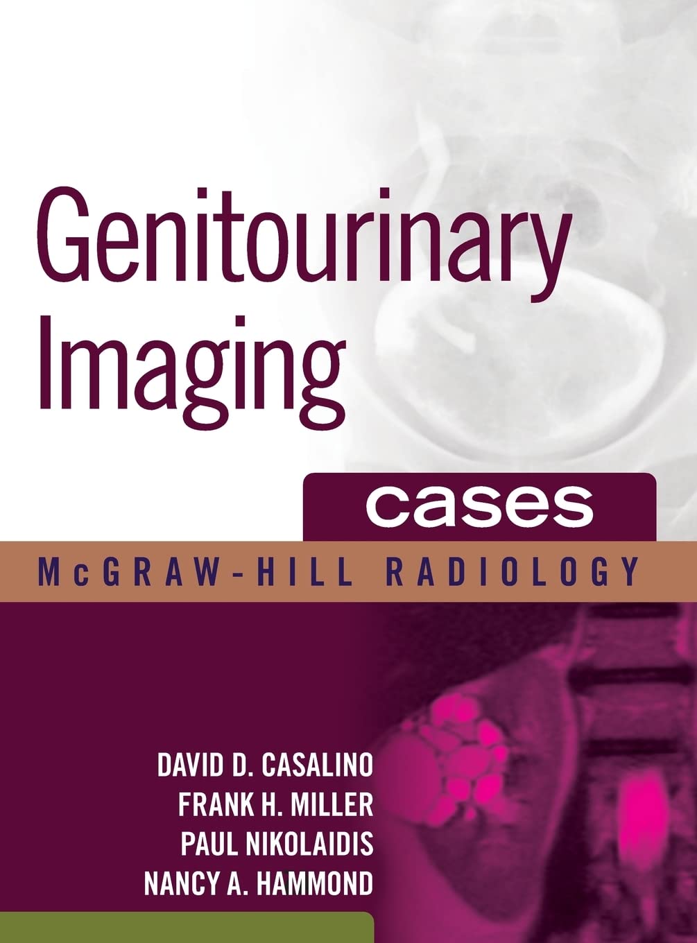 Genitourinary Imaging Cases - Radiology Diagnosis & Medical Education for Urology & Nephrology - Perfect for Medical Students, Residents & Radiologists