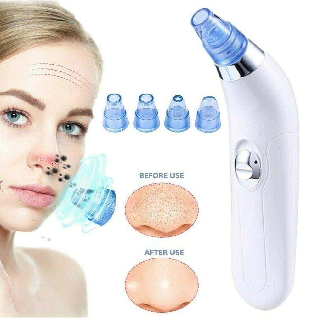 House of Sensation Pore Cleaner Kit - 4 Changeable Probes, Rechargeable Blackhead Remover Vacuum with Strong Suction - Facial Cleansing Device for Face, Nose & Skin - Perfect for Acne Prone & Oily Skin Care Routine