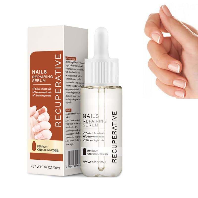 7 Days Nail Growth & Strengthening Serum - Fast Acting Nail Repair Treatment for Stronger, Healthier Nails - Nail Care Solution for Weak, Brittle, or Damaged Nails - Perfect for Home & Salon Use (1pc)