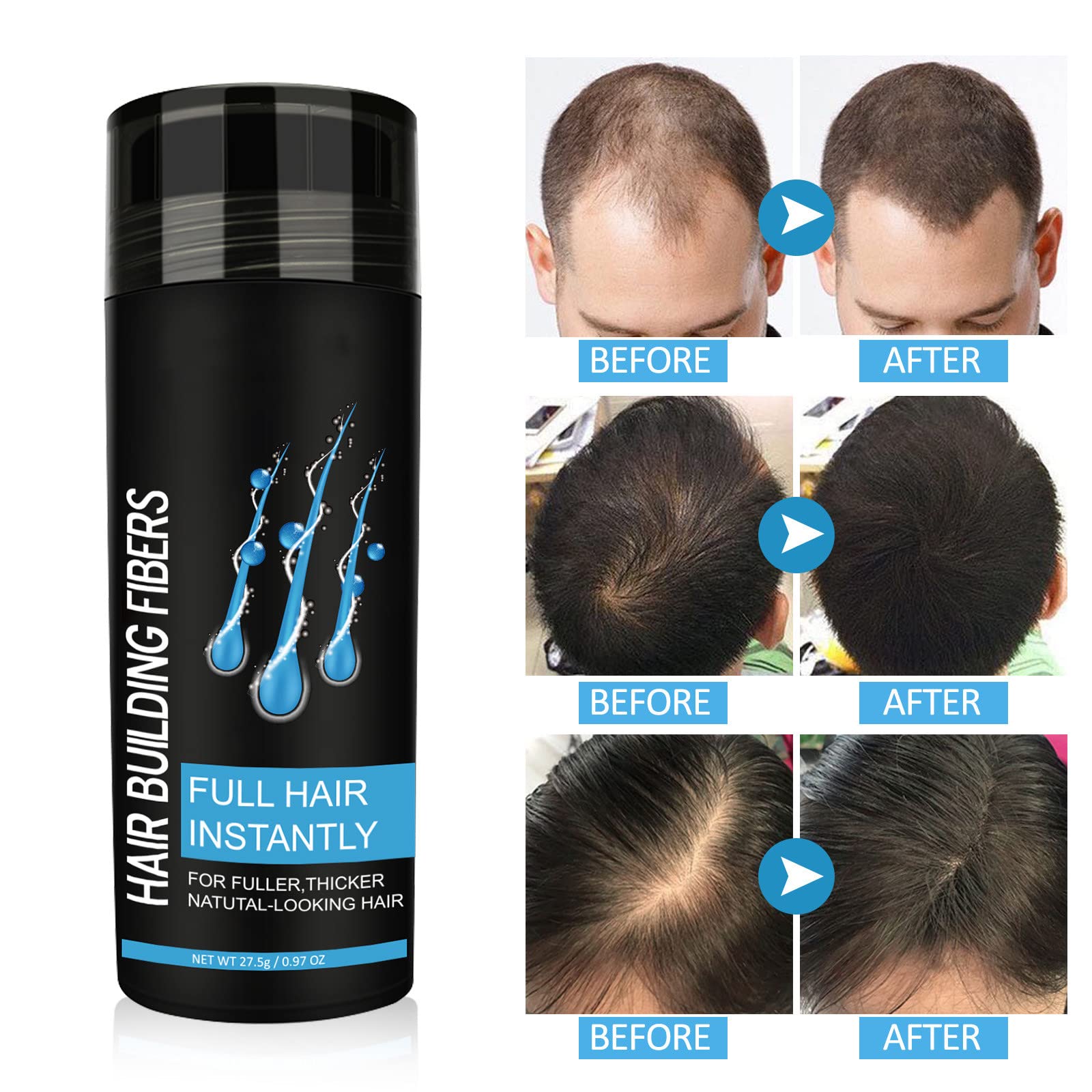 Premium Hair Building Fibers for Thinning Hair - Black Hair Loss Concealer Spray for Women & Men | Instant Coverage for Bald Spots & Thinning Areas | Great for Daily Use, Special Occasions & Confidence Boosting