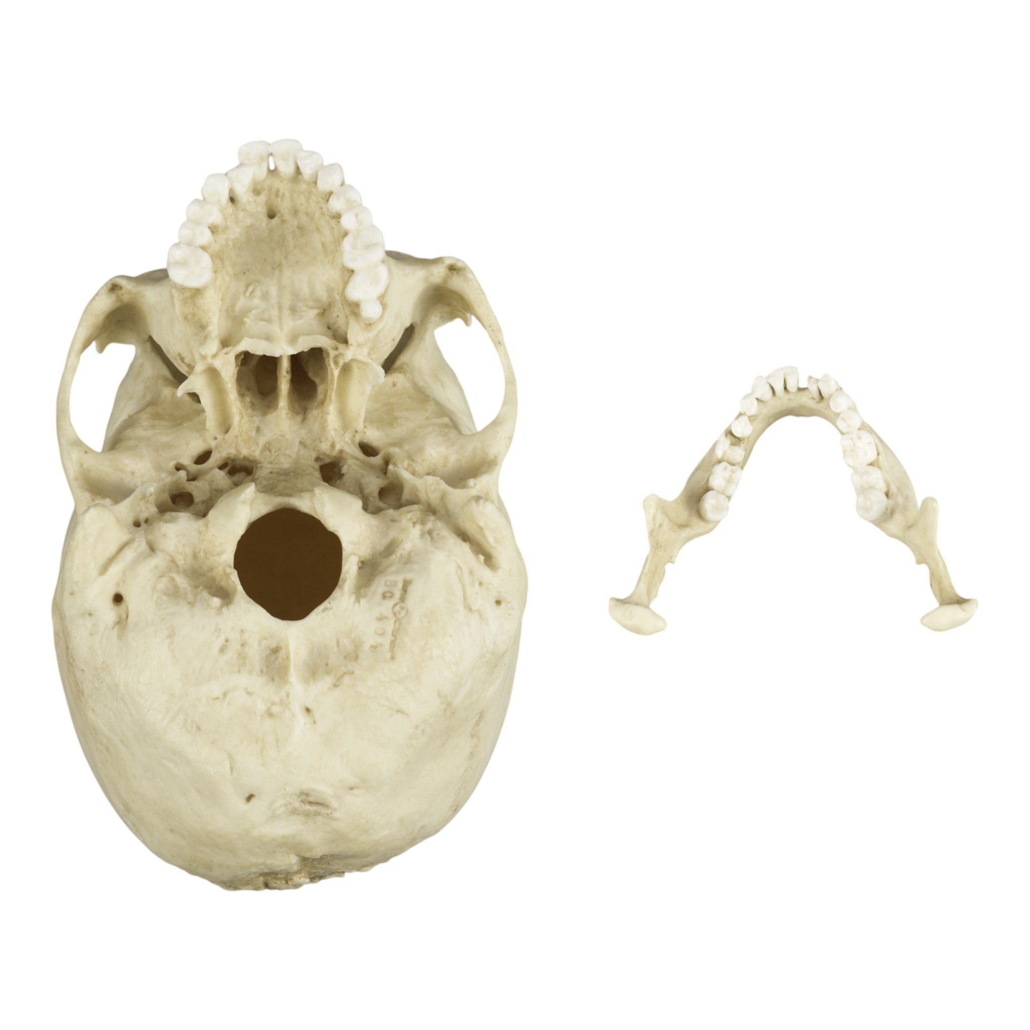Authentic Replica Human Skull with Syphilis - Anatomical Model for Medical Study, Halloween Decor & Gothic Collection - Perfect for Doctors, Students & Dark Aesthetic Lovers