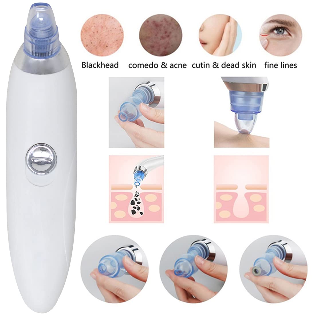 Adbeni 4-in-1 Multi-Function Blackhead & Whitehead Remover Tool - Acne Pimple Extractor & Pore Vacuum Cleaner for Face, Nose & Skin Care - Perfect for Daily Facial Cleansing & Spa Treatments (White)