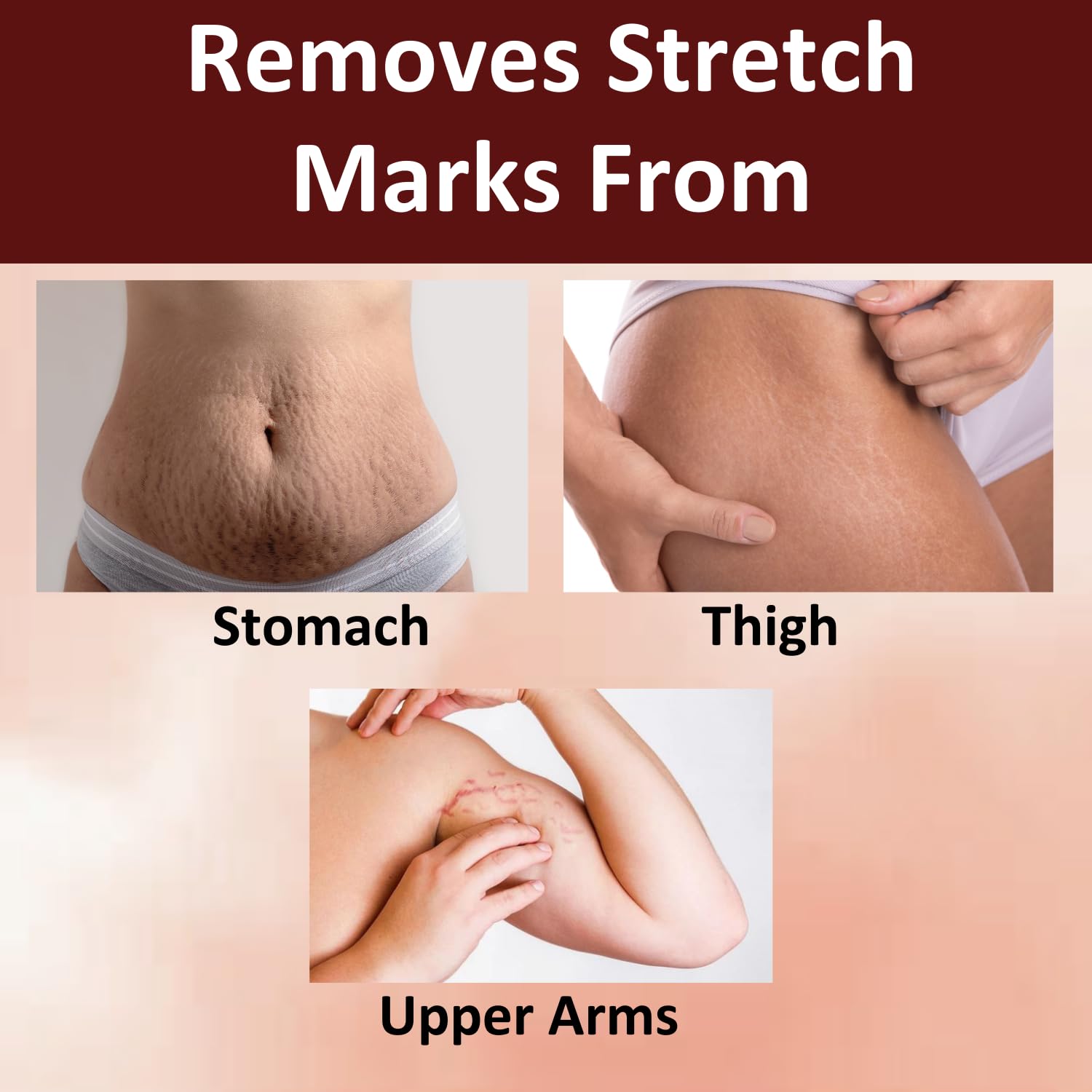 INTIMIFY Stretch Marks Oil & Cream for Women - Pregnancy Safe, 30ml - Hydrating & Nourishing for Belly, Hips & Thighs - Perfect for Pre & Postpartum Care & Daily Skin Moisturizing