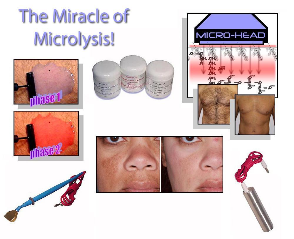 Laser-Free Permanent Hair Removal System with Microlysis Gel Kit - At-Home IPL Device for Smooth Skin - Perfect for Legs, Underarms, Bikini Line & Full Body Hair Removal