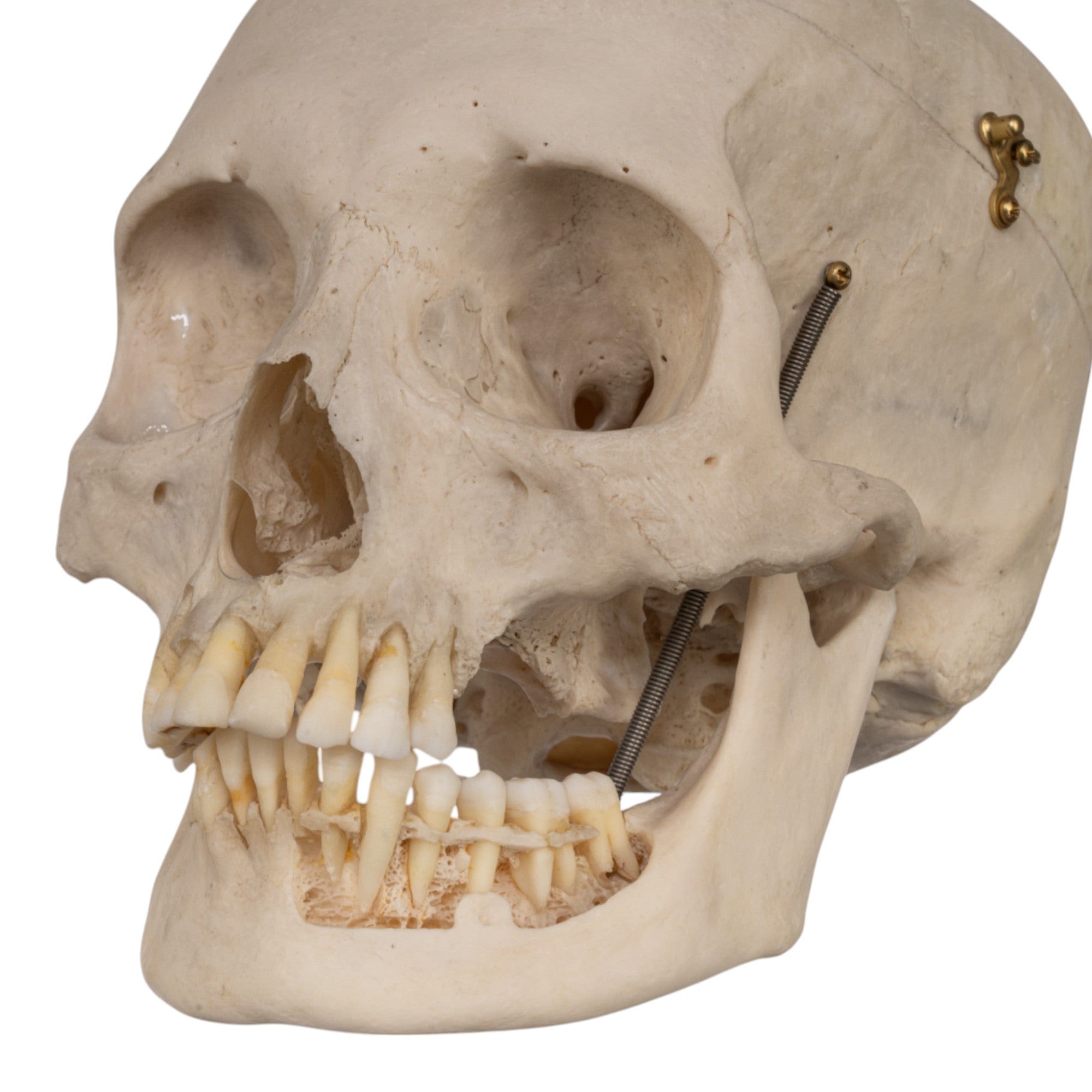 Real Human Skull with Exposed Teeth - Perfect for Halloween Decor, Medical Study, and Horror Movie Props