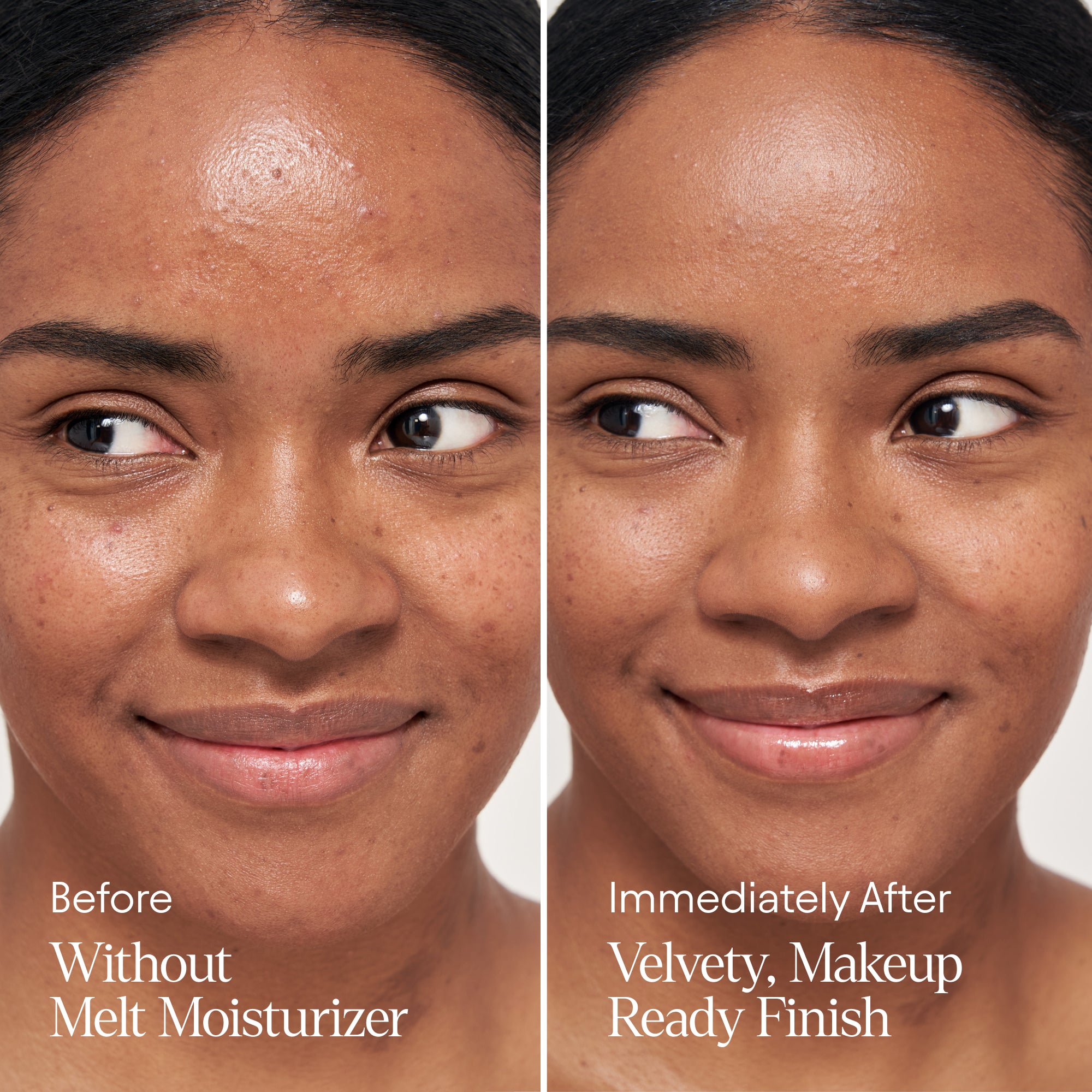 Melt Moisturizer - Hydrating Face Cream for Dry Skin | Natural Ingredients for Deep Moisture | Perfect for Daily Skincare Routine & Nighttime Hydration