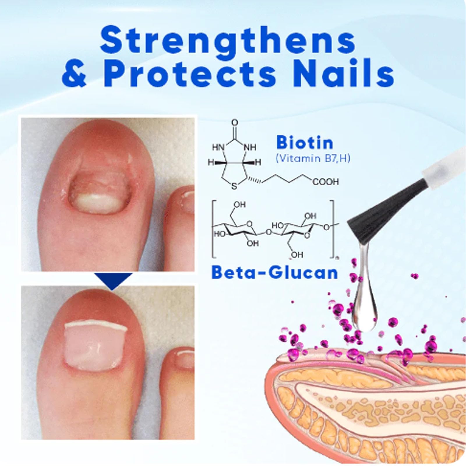 Onyxoguard Nail Growth & Repair Serum - Best Nail Strengthener for Thin & Brittle Nails - Natural Nail Care Treatment with Keratin & Vitamins (2 Pack) - Perfect for Weak, Peeling Nails & Faster Growth at Home or Salon