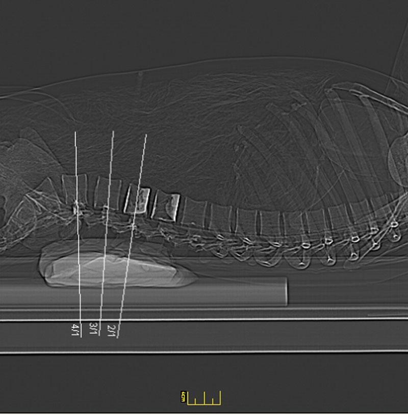Full Body X-Ray Phantom with Real Human Skeleton Bones - High-Quality Medical Training Model for Radiology, Anatomy Studies & X-Ray Positioning Practice (Ideal for Medical Schools, Hospitals & Research Labs)
