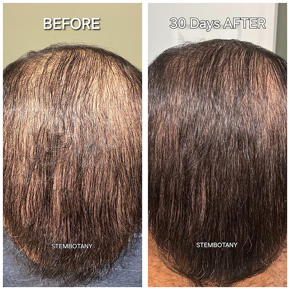 GHK-Cu Copper Peptide Hair Growth Shampoo for Men & Women - Stimulates Hair Regrowth, Thickens & Strengthens Hair - Ideal for Thinning Hair & Scalp Care (For Daily Use at Home & Salon)