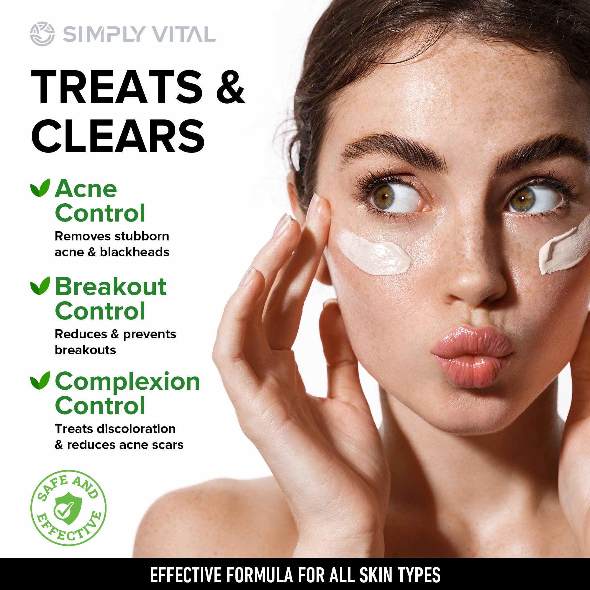 Fast-Acting Acne Treatment Cream for Stubborn Pimples, Blackheads & Whiteheads - Made in USA | Soothing Moisturizer for Inflammation Relief & Acne Scar Prevention (2oz) - Perfect for Daily Skincare Routine & Teen/Adult Acne Care