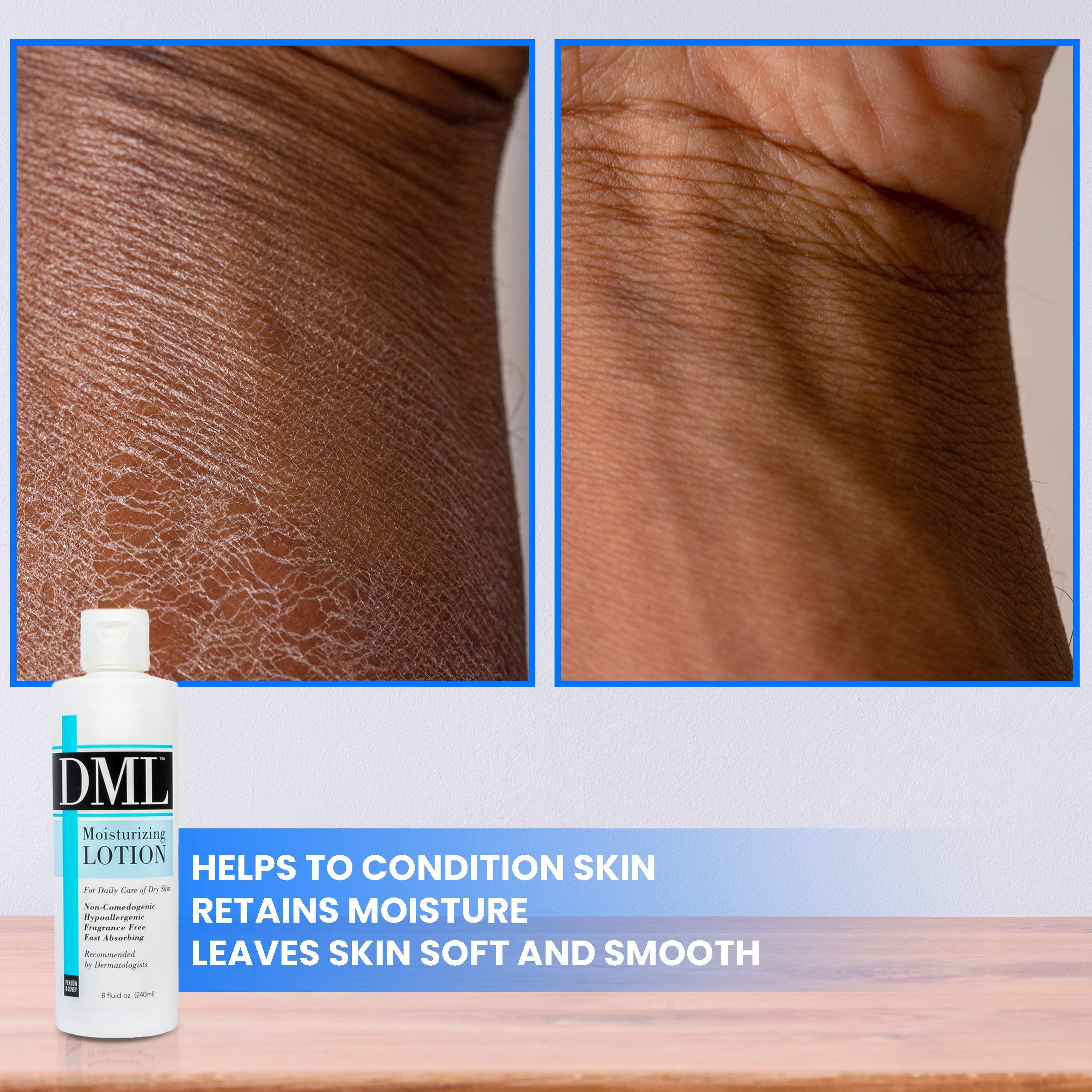 Dml Moisturizing Lotion for Dry Skin - Fragrance Free, Hypoallergenic, 8 Oz - Perfect for Daily Hydration & Sensitive Skin Care
