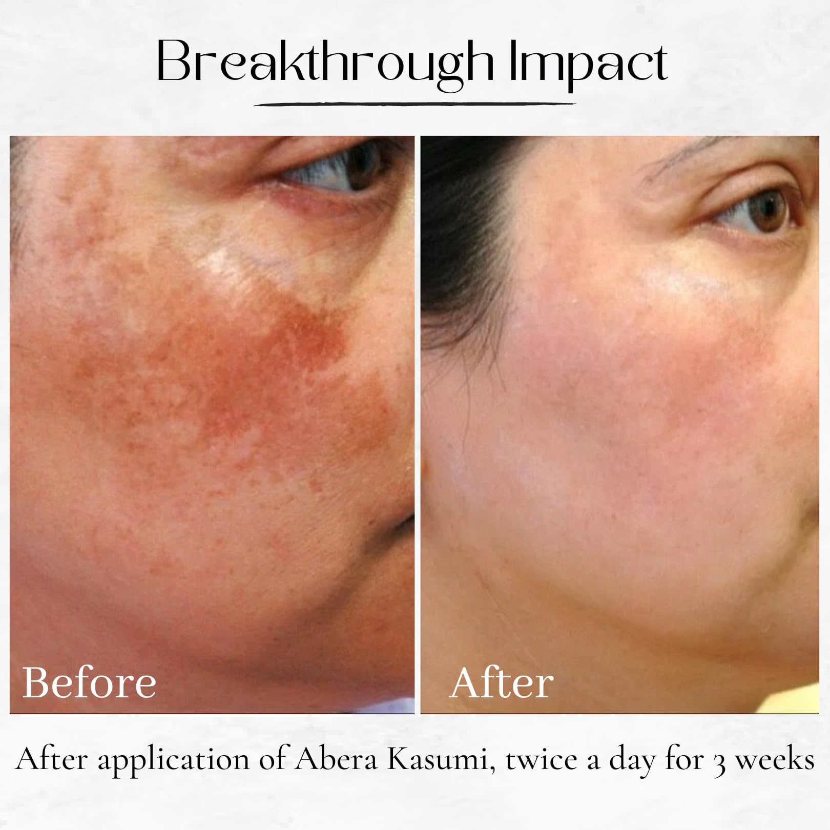 ABERA Kasumi Glowing Cream - Dark Spot Remover & Melasma Treatment for Face with Gold Eye Patches (0.7 Oz, 3 Boxes + 6 Eye Patches) | Brightening Skincare for Hyperpigmentation & Evening Skin Tone | Perfect for Daily Use & Nighttime Routine