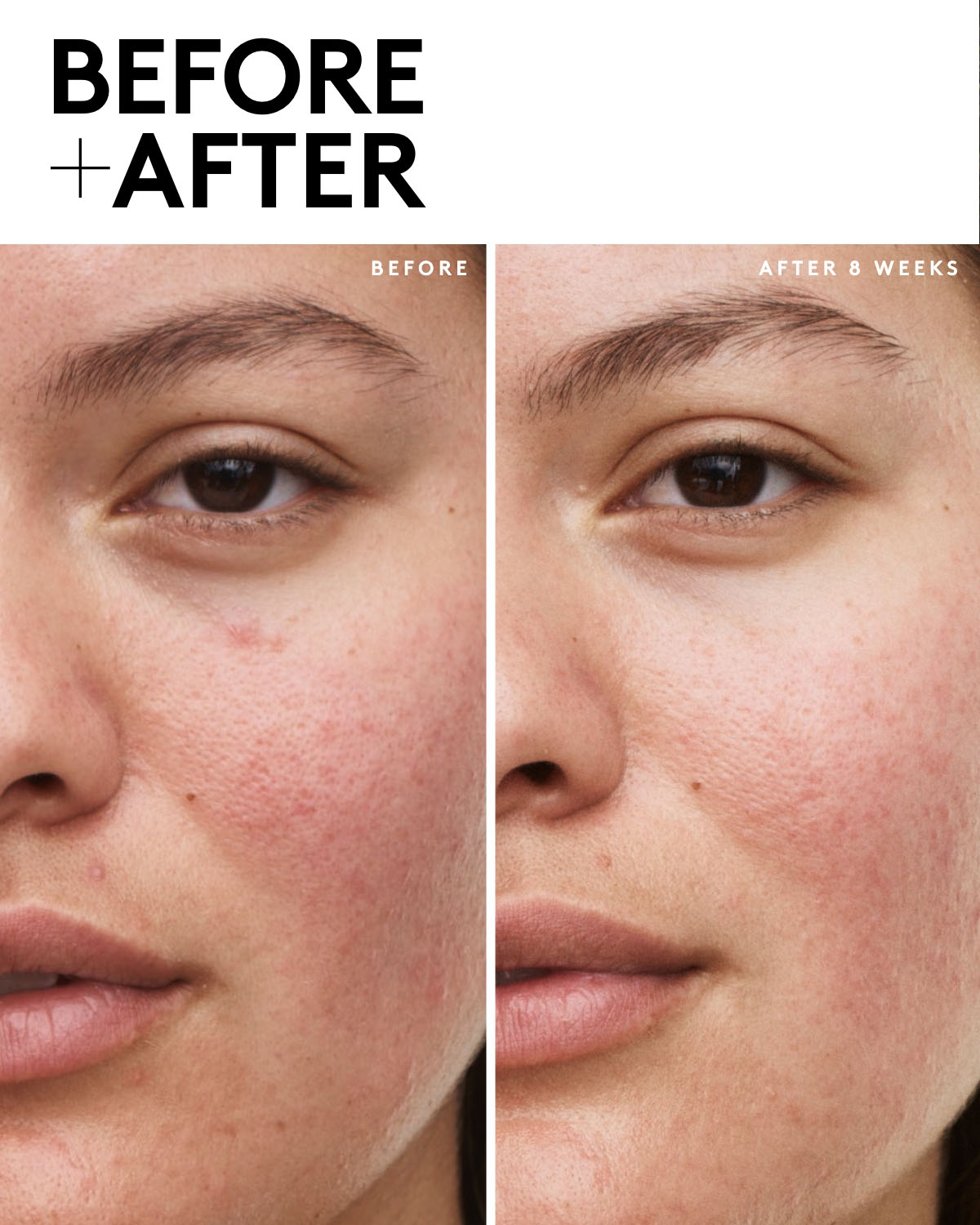 Fenty Skin Vault 5-Piece AM + PM Skincare Set with Mineral SPF 30 - Daily Face Care Routine for Glowing Skin | Morning & Night Hydration Bundle for All Skin Types