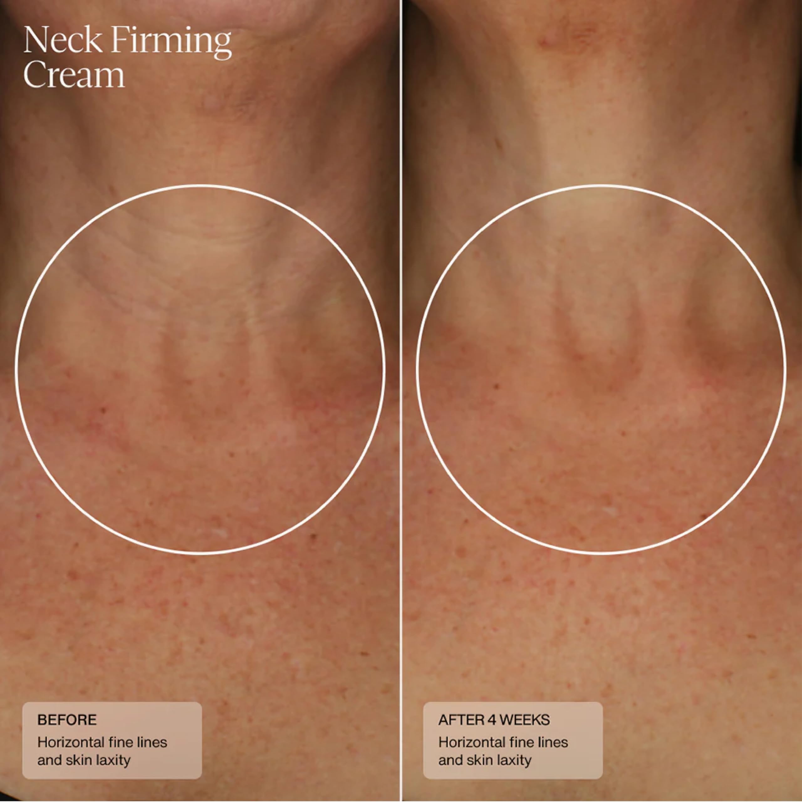 Sente Neck Firming Cream - Anti-Aging Neck Cream with HSA, Caffeine & Vitamin C for Wrinkle Reduction & Skin Tightening - 1.7 Oz - Perfect for Daily Skincare Routine & Nighttime Use