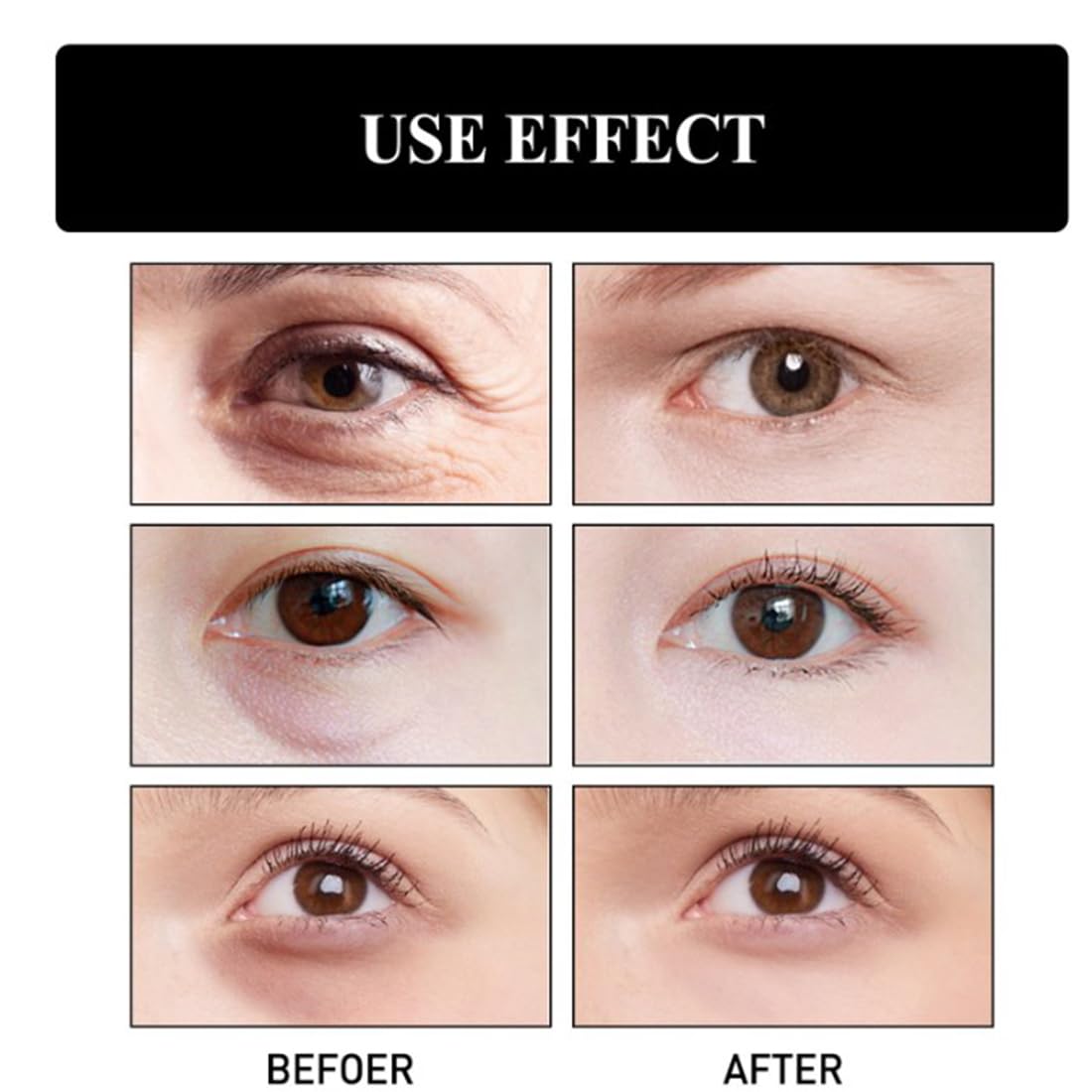Best Eye Serum for Dark Circles & Puffiness - Fast-Acting Under Eye Treatment Stick for Instant Firming & Wrinkle Reduction - Perfect for Morning Routine & Travel Skincare