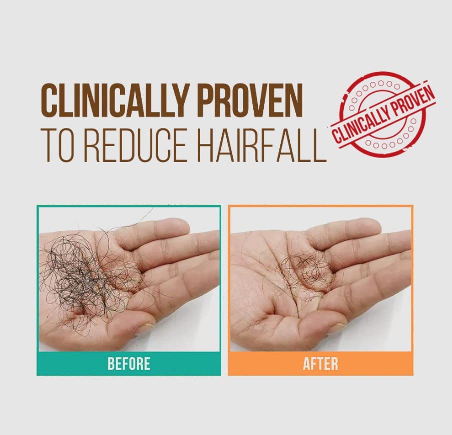 Zenius Hair Pro Oil for Hair Growth & Hair Fall Control - Natural Hair Treatment for Thicker, Stronger Hair | Pack of 2 | Perfect for Daily Scalp Massage & Damaged Hair Repair