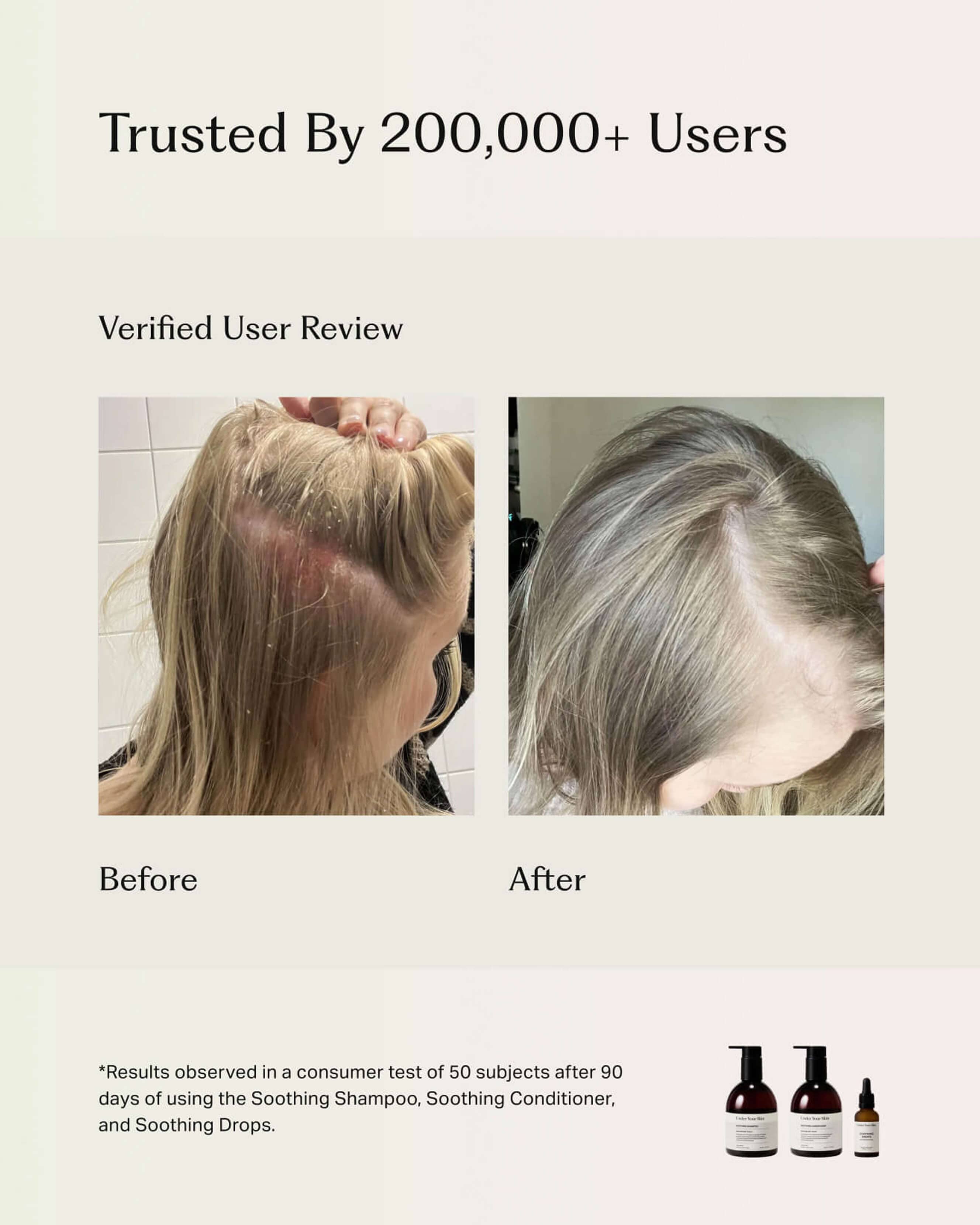Soothing Scalp Treatment Drops for Dry Itchy Scalp - Natural Hair Care Solution for Dandruff Relief & Scalp Hydration - Perfect for Daily Use at Home or Salon