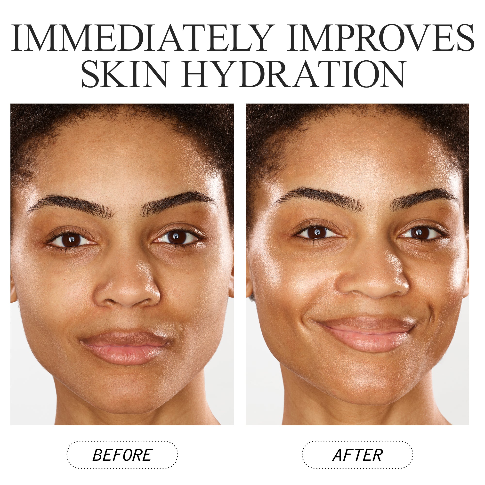 Skin Biome Hydration & Repair Cream - Moisturizing Face & Body Lotion for Dry Skin Relief - Perfect for Daily Skincare Routine & Post-Workout Recovery