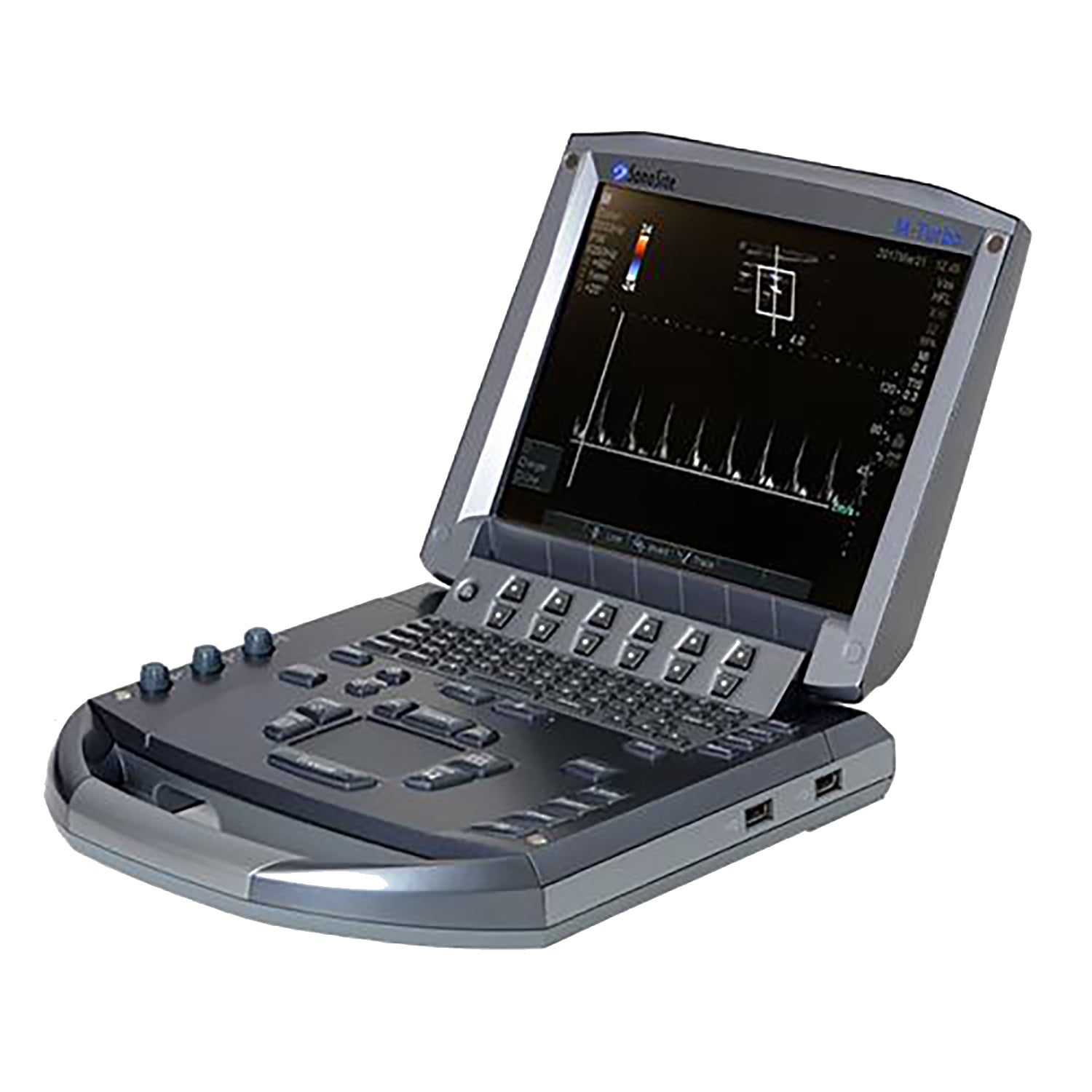 Sonosite M-Turbo Portable Ultrasound System - High-Performance Handheld Ultrasound for Medical Professionals | Ideal for Emergency, Point-of-Care & Clinical Diagnostics
