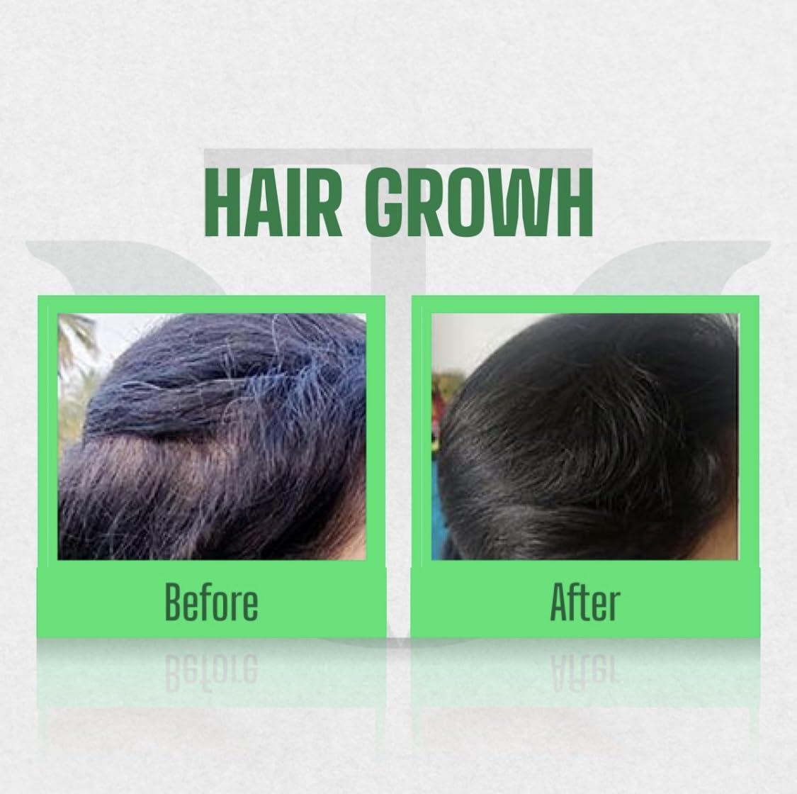 Vikash Thailas Advance Herbal Hair Oil 300ml - Natural Hair Growth Treatment for Dry, Damaged Hair - Perfect for Daily Scalp Massage & Hair Care Routine