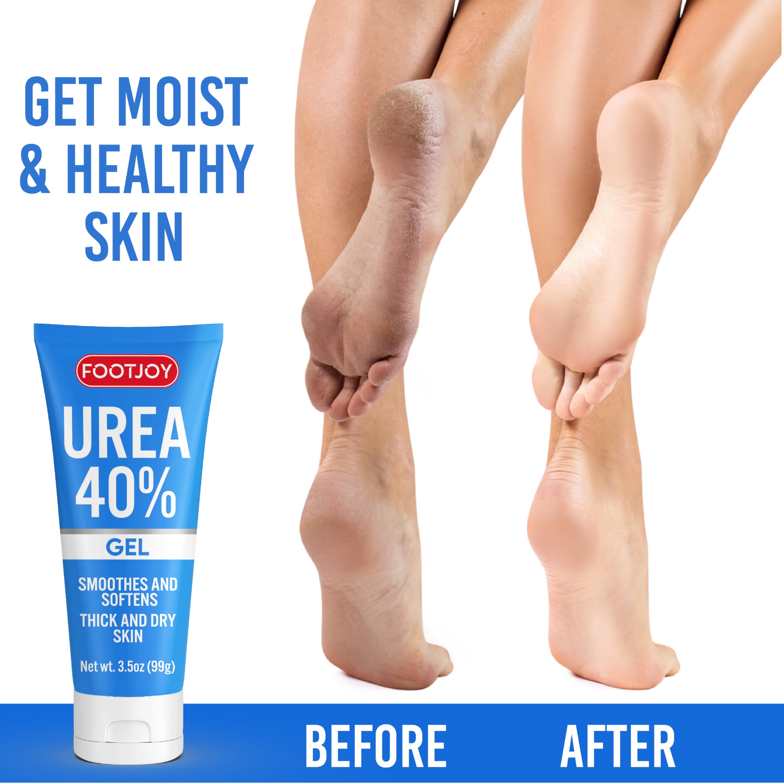 FOOTJOY Urea Gel 40% - Intensive Foot Cream for Cracked Heels, Dry Feet & Rough Skin - Moisturizing Foot Spa Treatment with 40% Urea - Perfect for Cracked Heel Repair & Soft Baby Feet - Ideal for Daily Foot Care, Pedicures & At-Home Spa Treatments