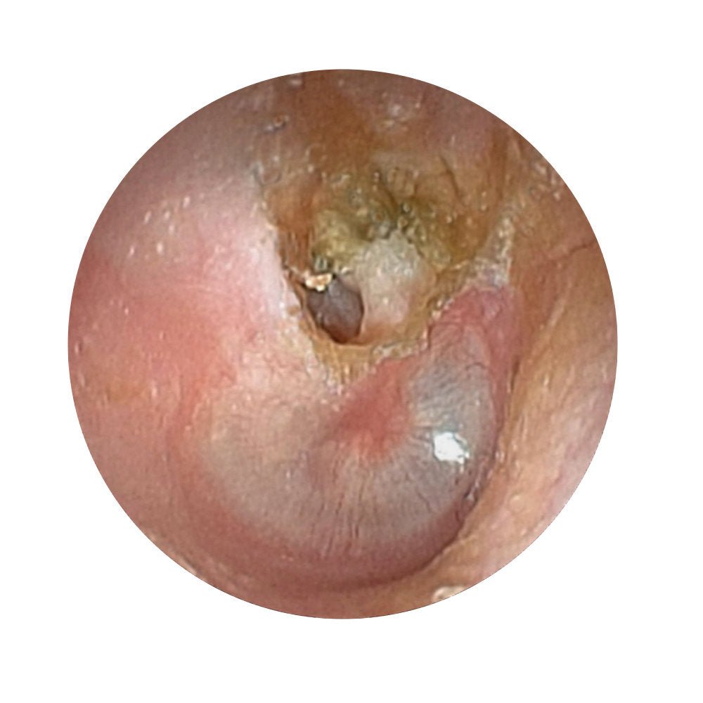Ear Examination Simulator II - Professional Otoscopy Training Model for Medical Students & Doctors - Perfect for ENT Clinics, Medical Schools & Healthcare Training