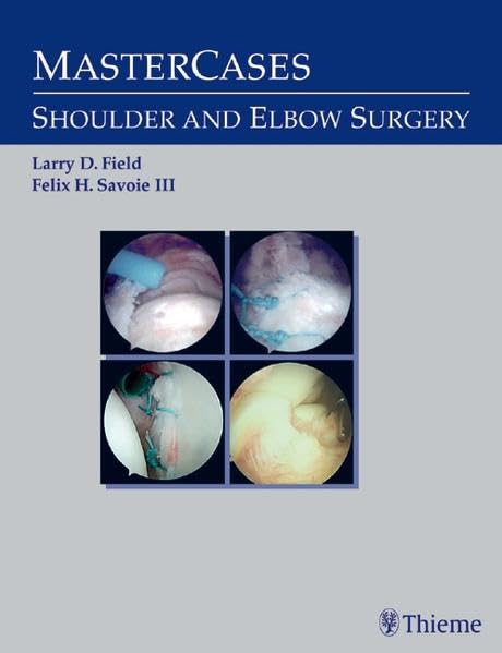 Mastercases in Shoulder & Elbow Surgery - Comprehensive Guide for Orthopedic Surgeons | Clinical Case Studies & Surgical Techniques for Joint Procedures