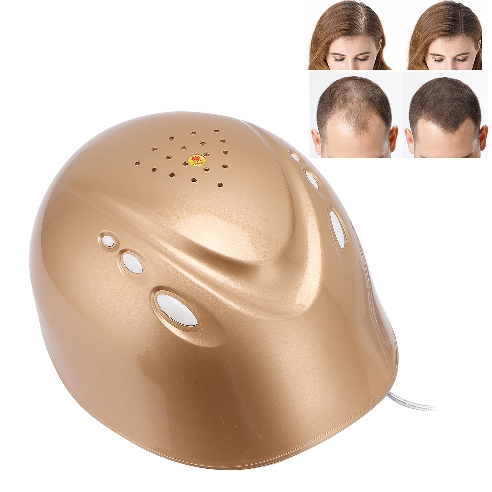 Professional Hair Growth Helmet with 160 Laser Chips - Effective Hair Loss Treatment Device for Men & Women - Portable Laser Therapy for Thicker, Fuller Hair - At-Home Hair Regrowth Solution for Daily Use