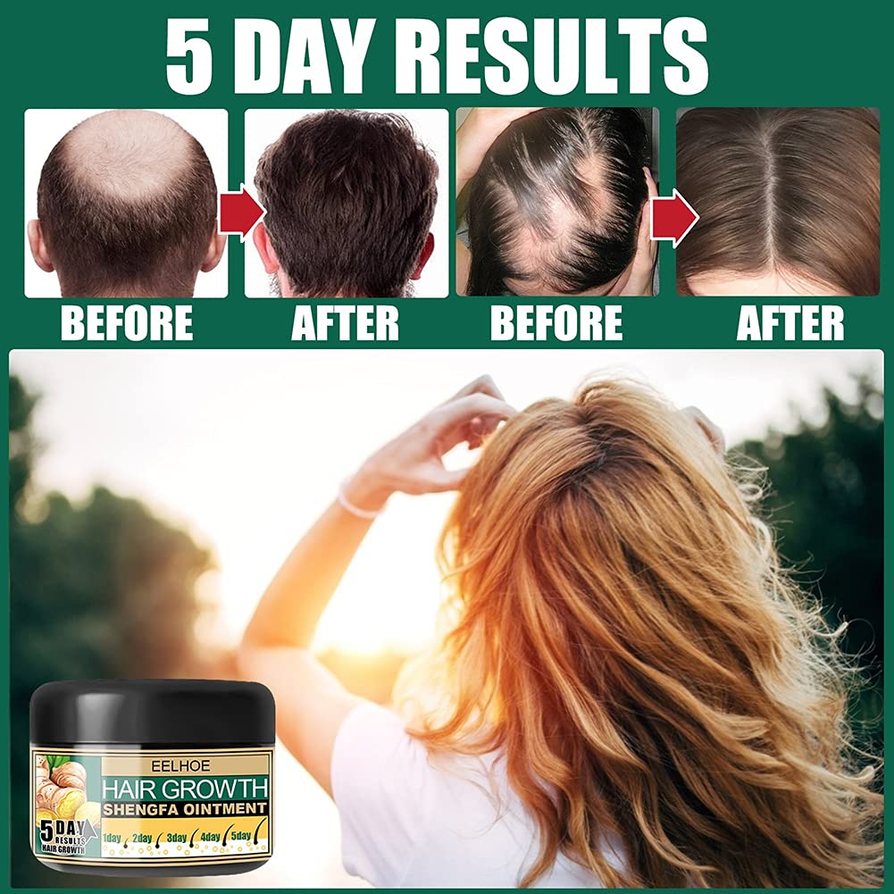 Hair Growth Cream for Bald Spot Treatment - Scalp Moisturizer & Follicle Conditioner for Men & Women - Promotes Hair Regrowth & Scalp Massage - Ideal for Thinning Hair & Daily Hair Care Routine