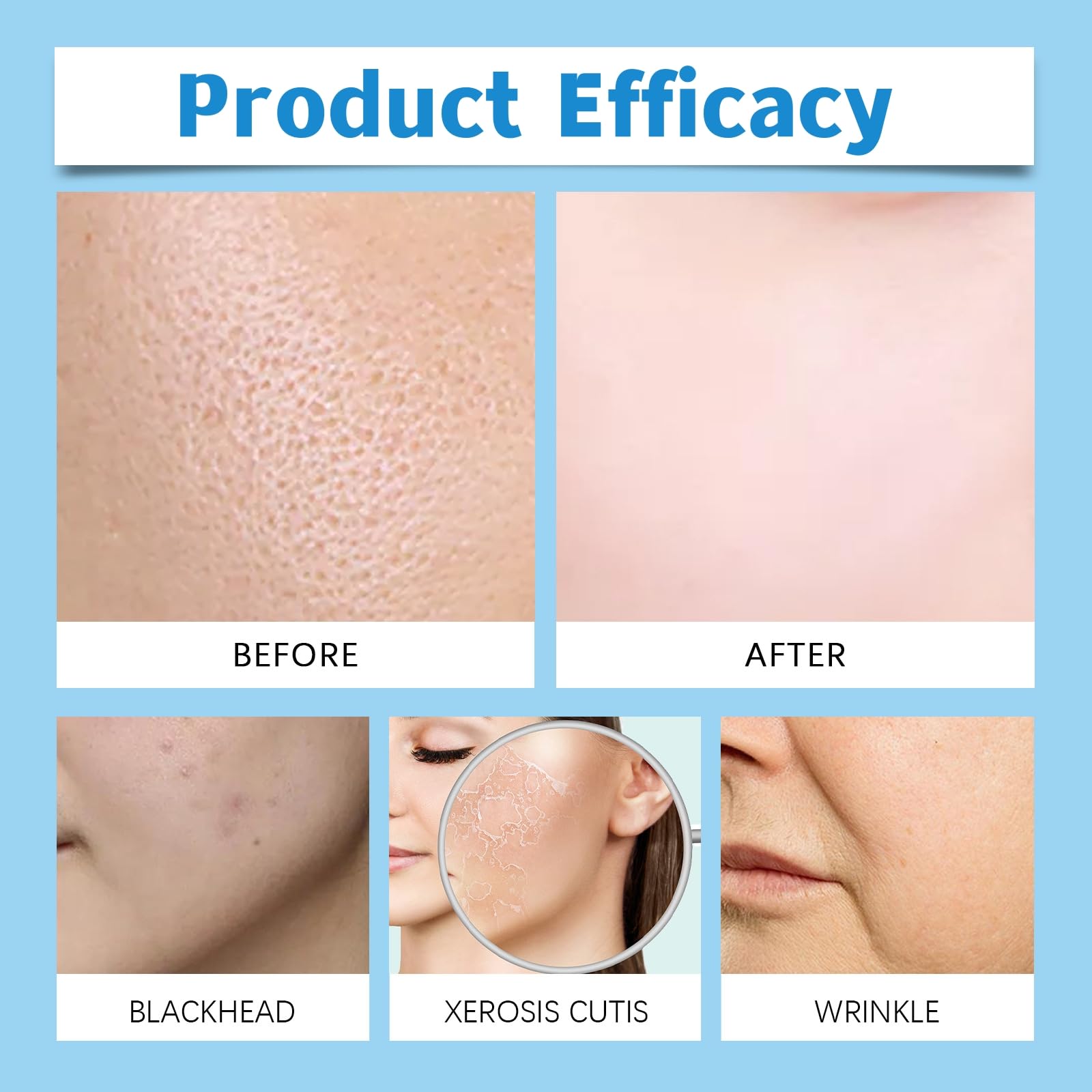Glamory Micro Infusion System for Face and Lips - Hyaluronic Acid Serum for Younger Skin, Anti-Aging Treatment with 8 Serums + 1 Bottle - Perfect for Daily Skincare Routine & Hydration Boost