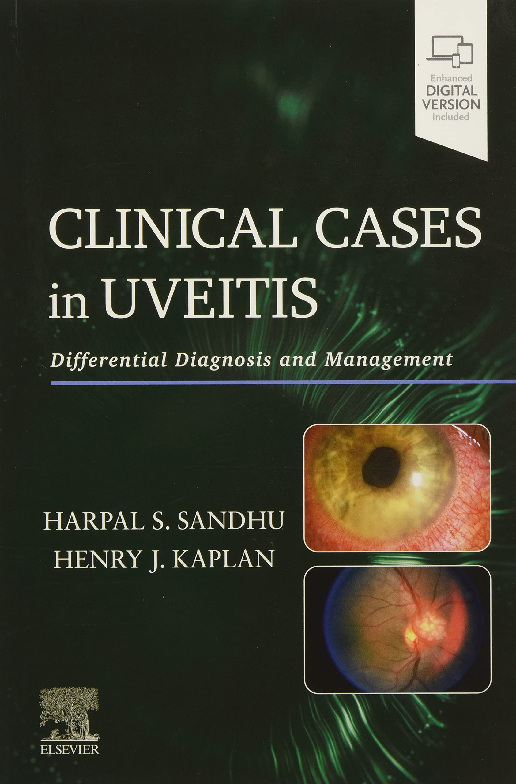 Clinical Cases in Uveitis: Differential Diagnosis & Treatment Guide for Ophthalmologists | Uveitis Management for Eye Specialists | Ideal for Medical Education & Patient Care Scenarios