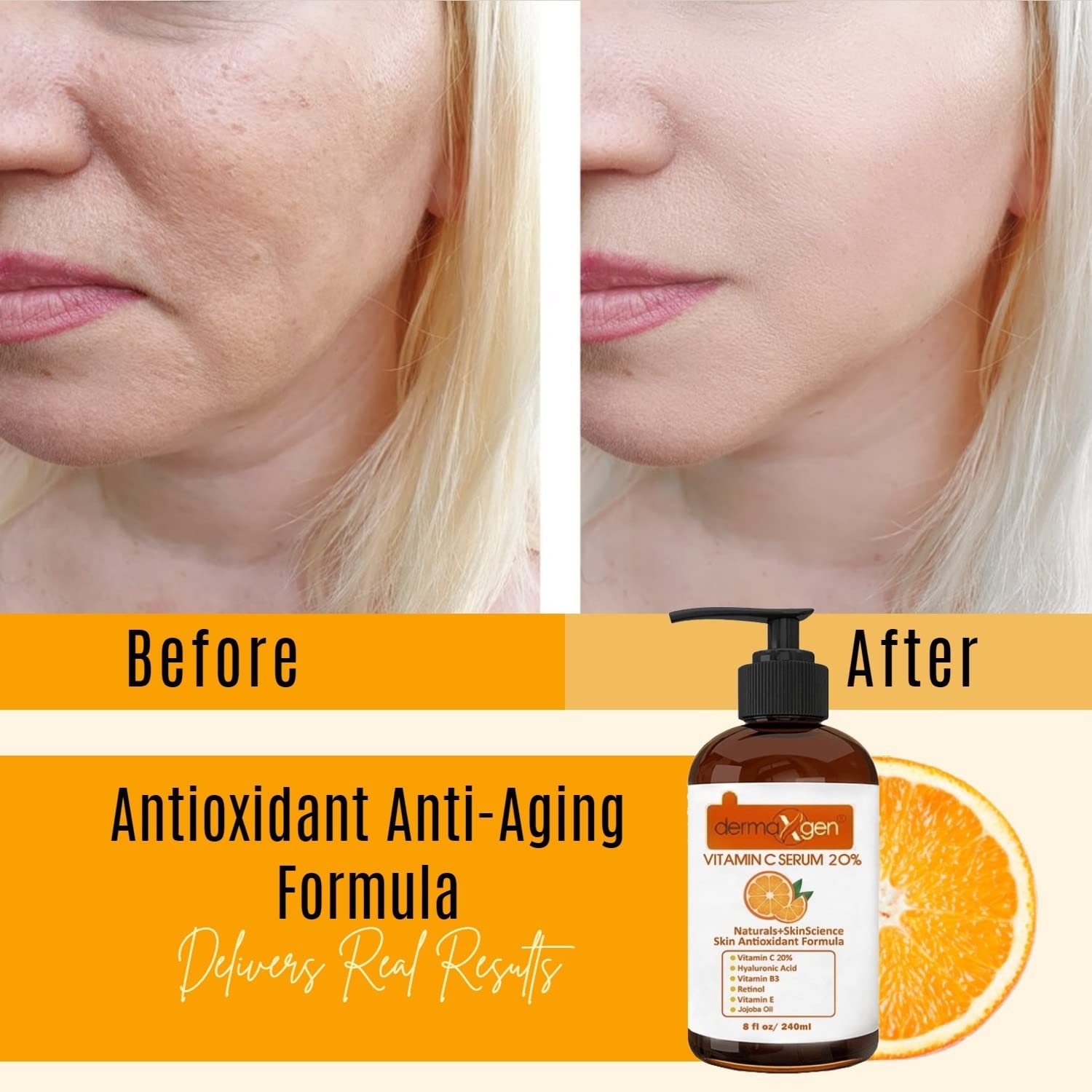 20% Vitamin C Serum with Hyaluronic Acid, Retinol, Vitamin E & B - Organic Anti-Aging Facial Treatment for Collagen Boost, Deep Hydration & Wrinkle Reduction (8 Fl Oz) | Perfect for Night Routine, Dry Skin Care & Daily Anti-Wrinkle Regimen