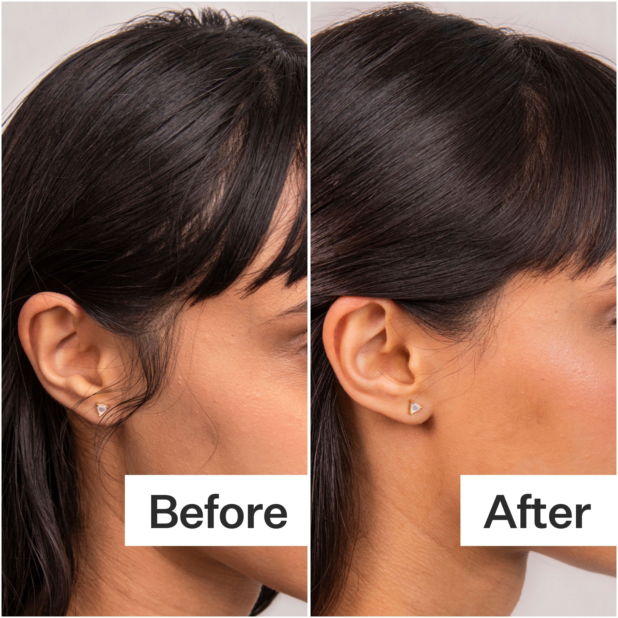 4% Niacinamide Scalp Serum for Oily Hair - Reduce Excess Oil & Soothe Irritation - Perfect for Daily Scalp Care & Hair Growth