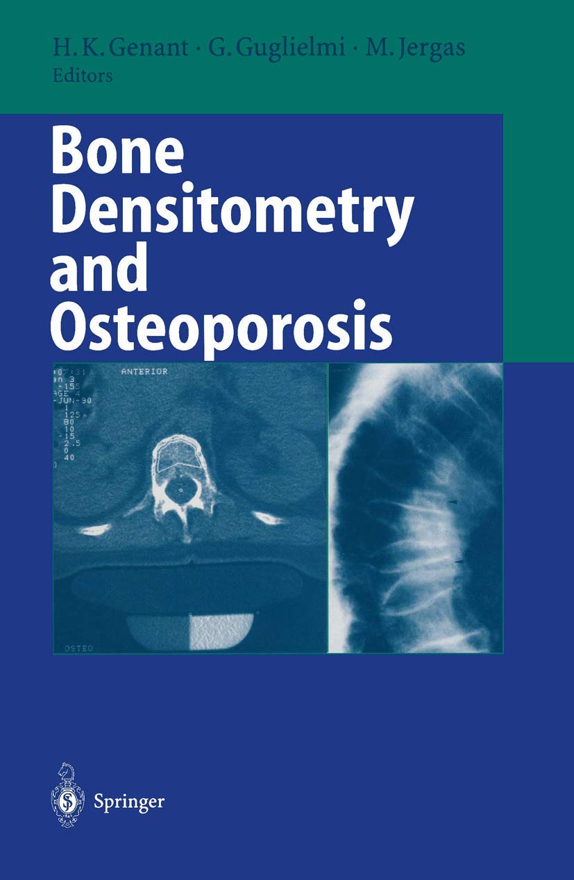 DEXA Bone Density Scanner for Osteoporosis Diagnosis - Accurate Bone Health Testing for Home & Clinical Use