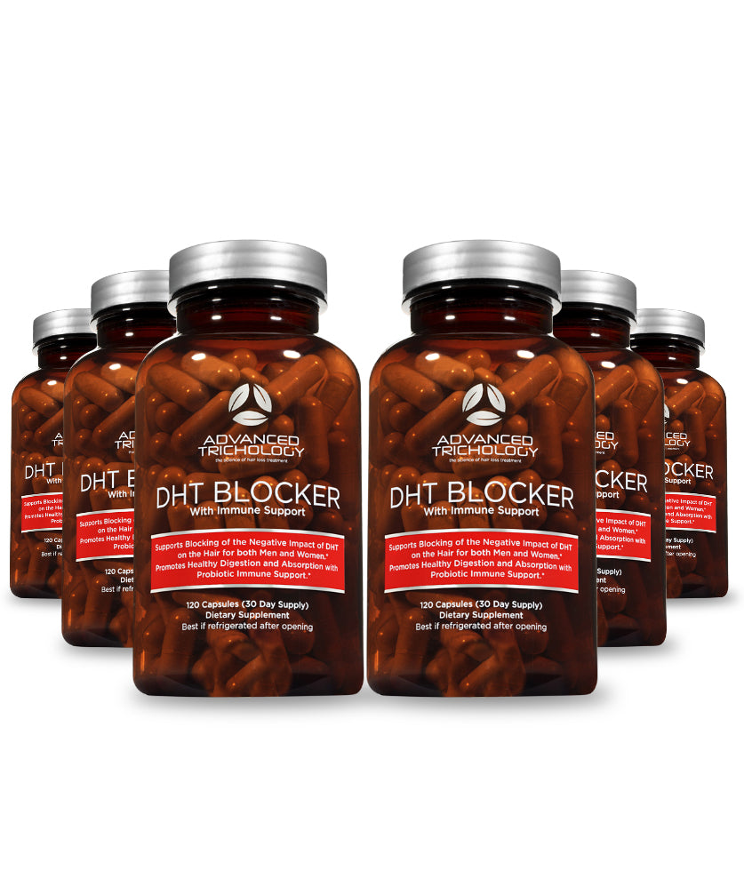 Natural DHT Blocker Supplement for Hair Growth & Immune Support - Supports Healthy Scalp & Thicker Hair - Ideal for Men & Women Concerned About Hair Thinning