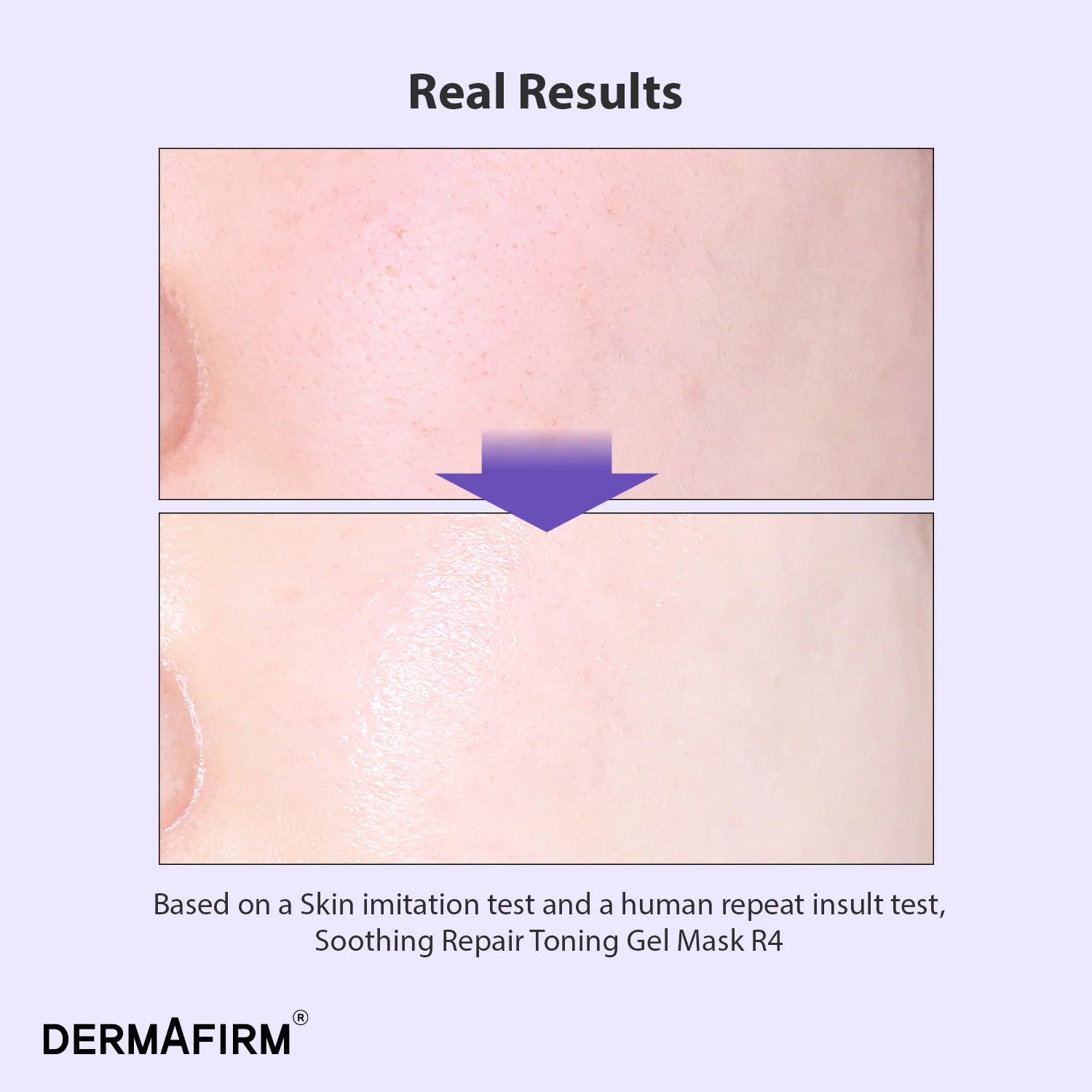 DERMAFIRM Soothing Repair Toning Gel Mask R4 (4 Sheets) - Hydrating & Calming Facial Sheet Mask for Sensitive Skin - Perfect for Post-Sun Care & Daily Skincare Routine