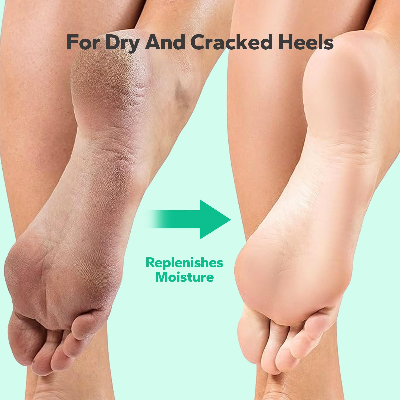 Professional Callus Remover Gel for Feet - Extra Strength 8.45 fl.oz Foot Care Treatment | Cracked Heel & Hard Skin Remover | At-Home Pedicure Solution for Soft Smooth Feet - Perfect for Dry Feet, Calluses & Rough Skin Care Routine