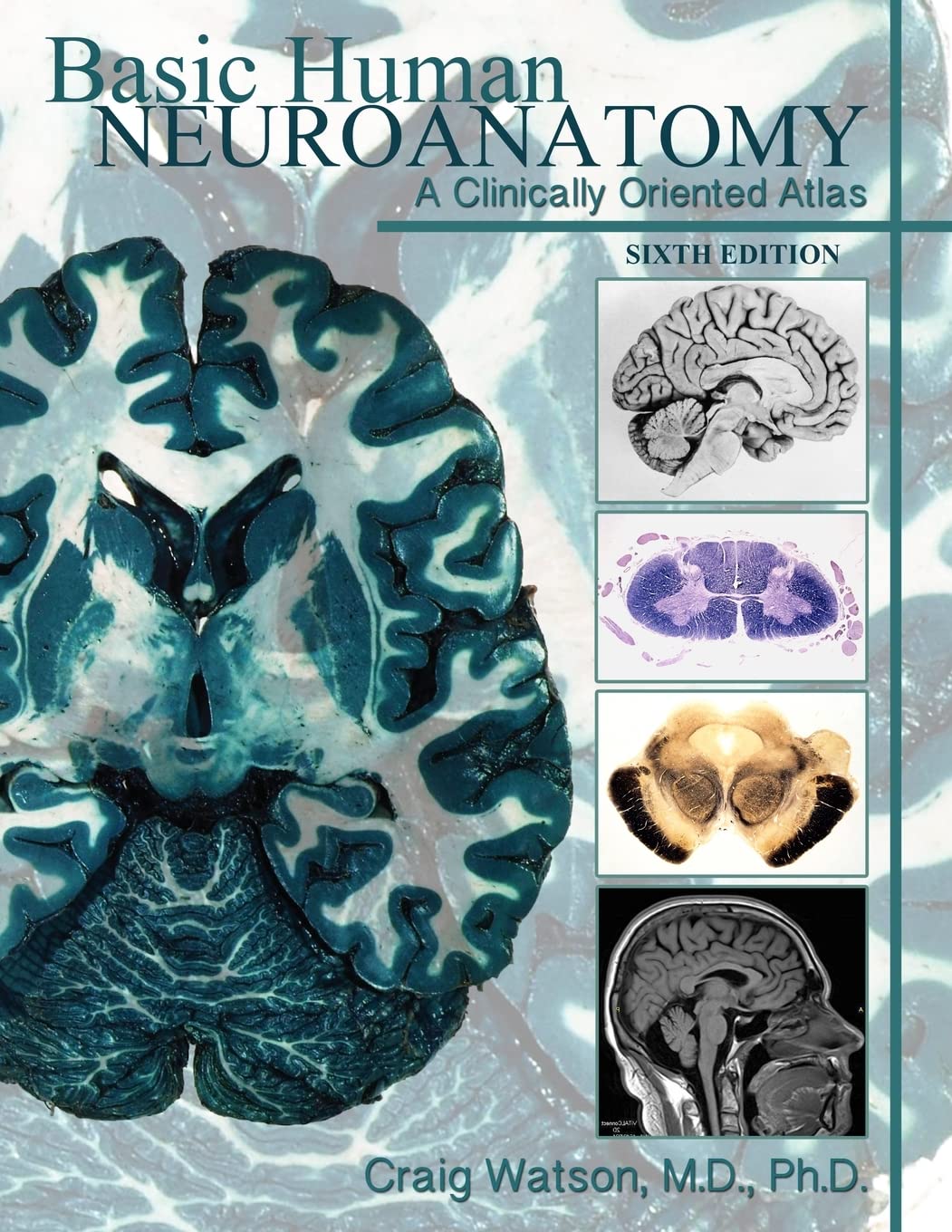 Basic Human Neuroanatomy: A Clinically Oriented Atlas - Essential Medical Reference for Students & Doctors | Neuroscience Study Guide & Clinical Practice Resource