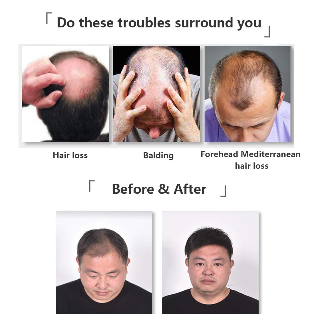 Premium Human Hair Toupee for Men - Natural Black Clip-in Hair Topper (6.3