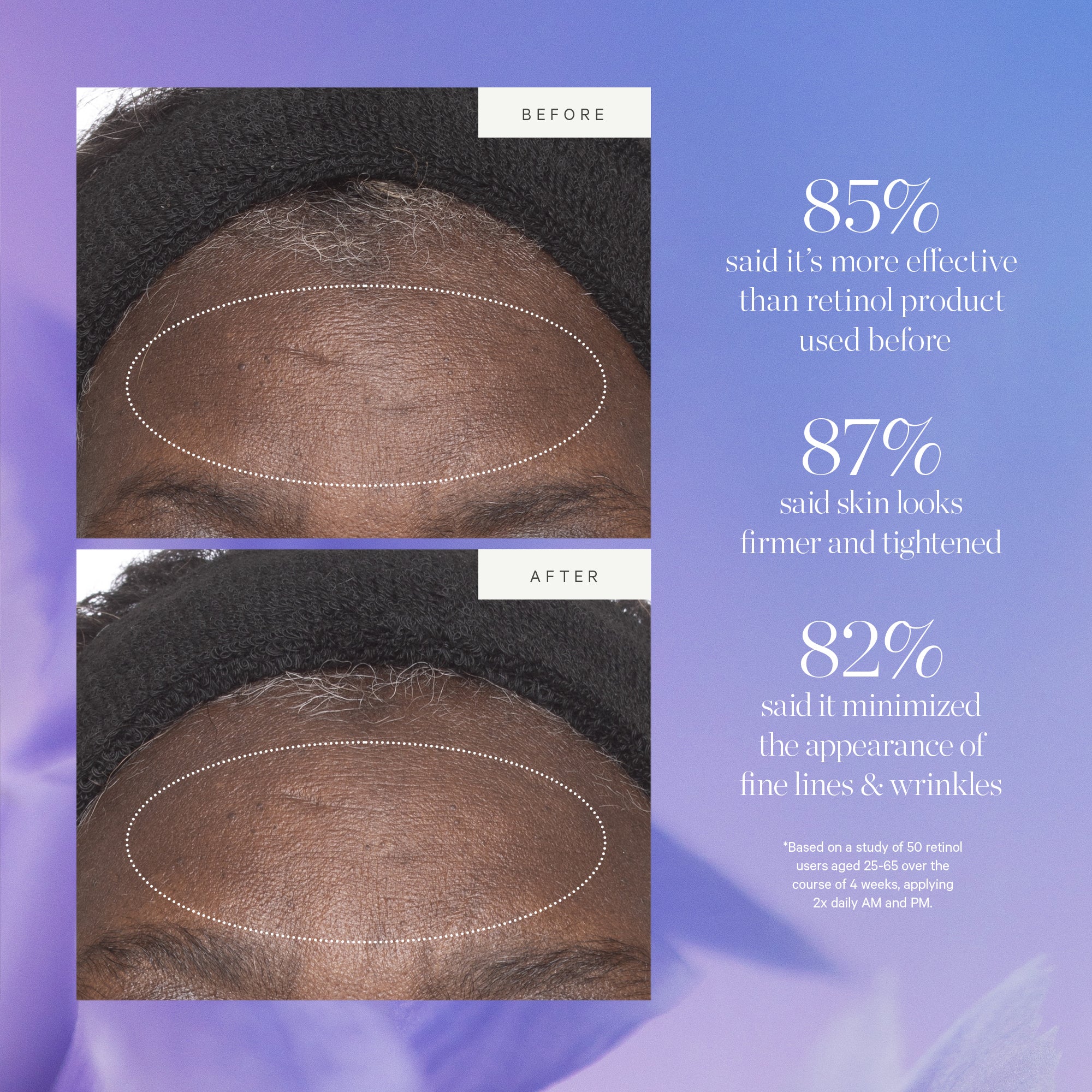 Plant Stem Cell Retinol Alternative Moisturizer - Anti-Aging Face Cream for Wrinkles & Fine Lines | Vegan, Cruelty-Free Skincare for Dry & Sensitive Skin | Perfect for Night Routine & Daily Hydration