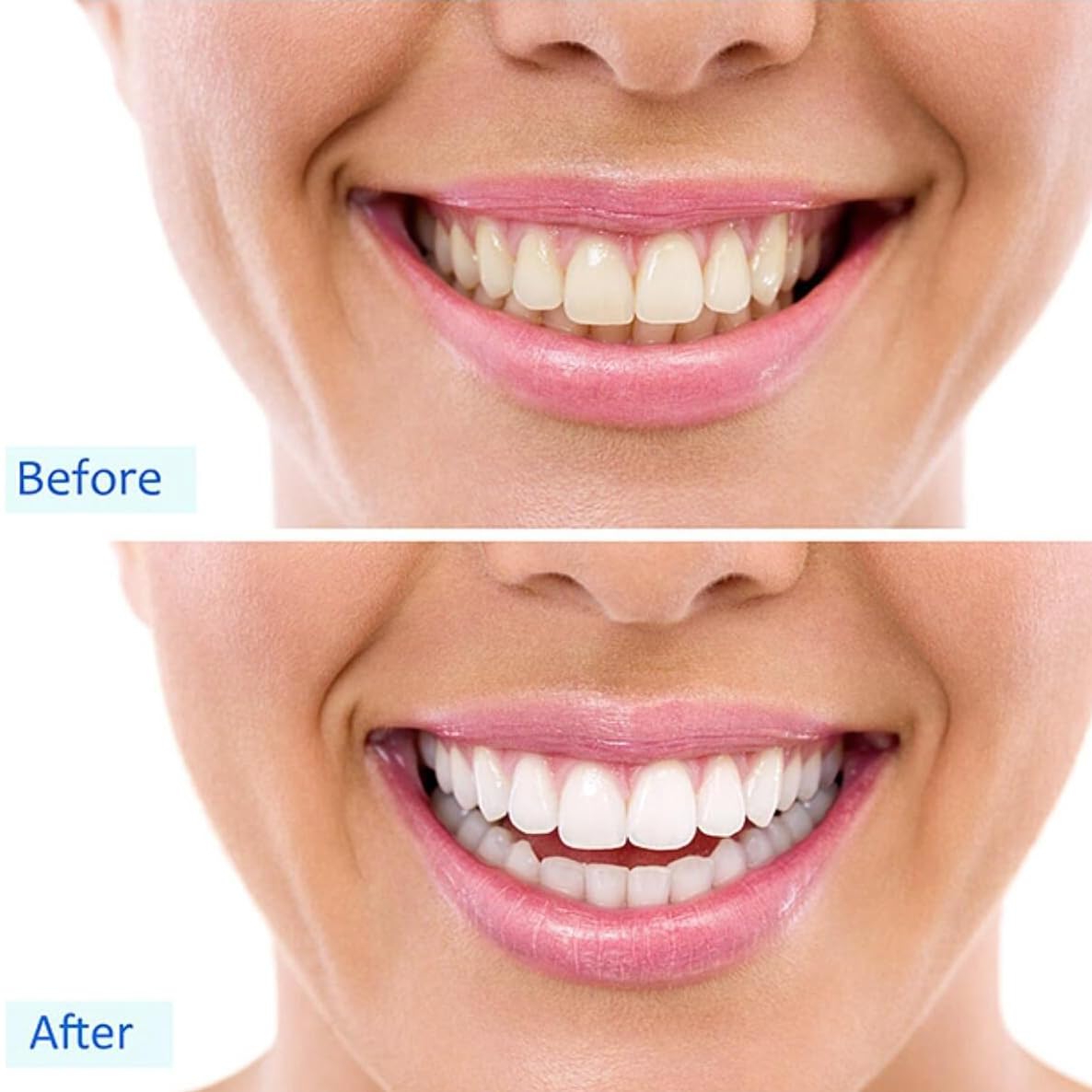 32 LED Teeth Whitening Accelerator Light with Cold & Red Light Therapy - Professional Teeth Whitening Kit with Built-in 16 Minute Timer (Black) - Perfect for Home Use, Travel, and Dental Care Routine