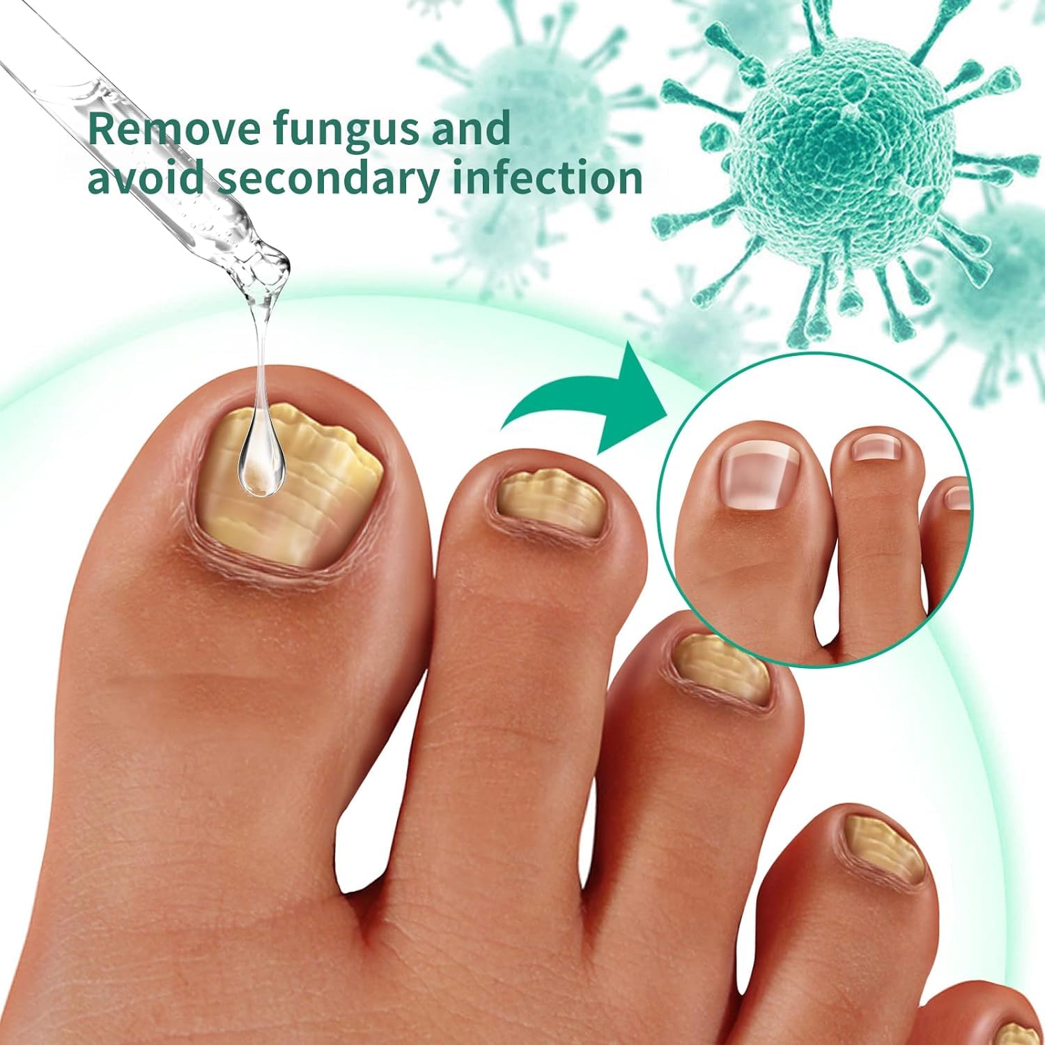 Extra Strength Toenail Fungus Treatment for Toenail & Fingernail - Fast-Acting Nail Repair Solution, Renewal Liquid for Damaged & Discolored Nails - Cool Blue (2 Pack) - Perfect for Athletes, Swimmers & Salon Professionals